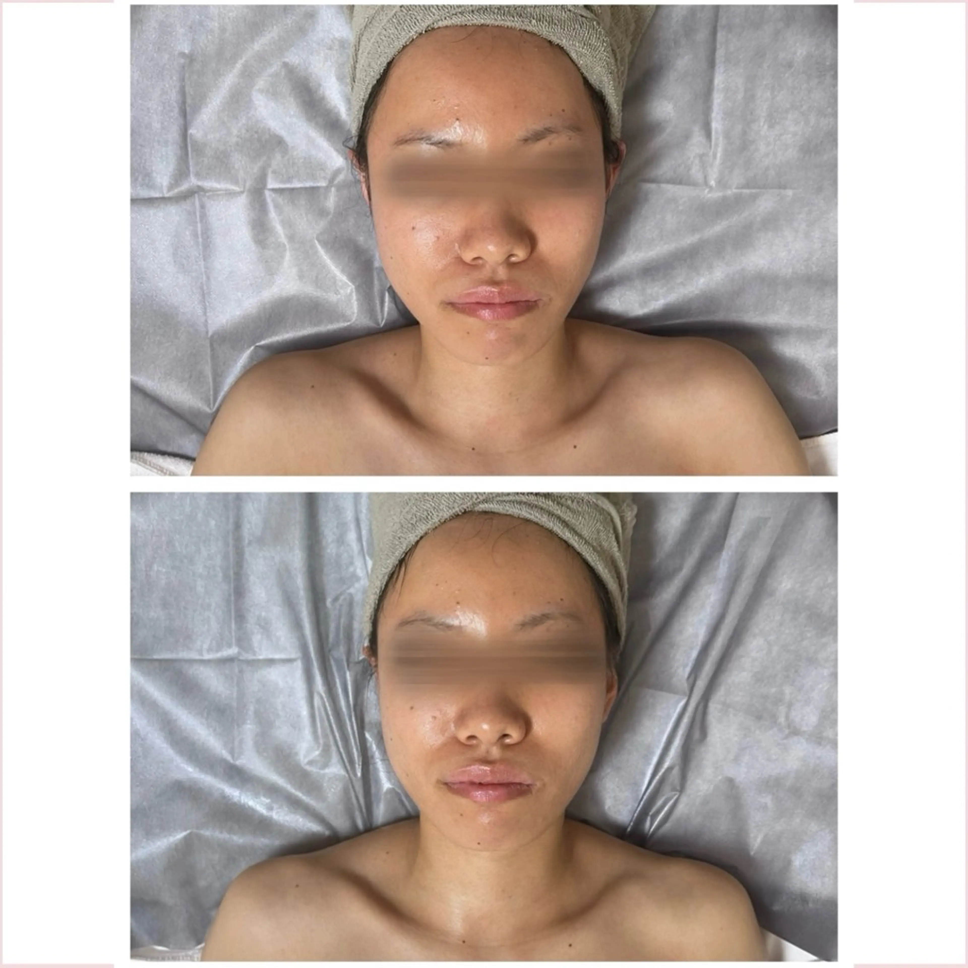 MELIA the beauty所属・肌のお悩み改善サロン MELIA/朋美のエステ・リラクイメージ