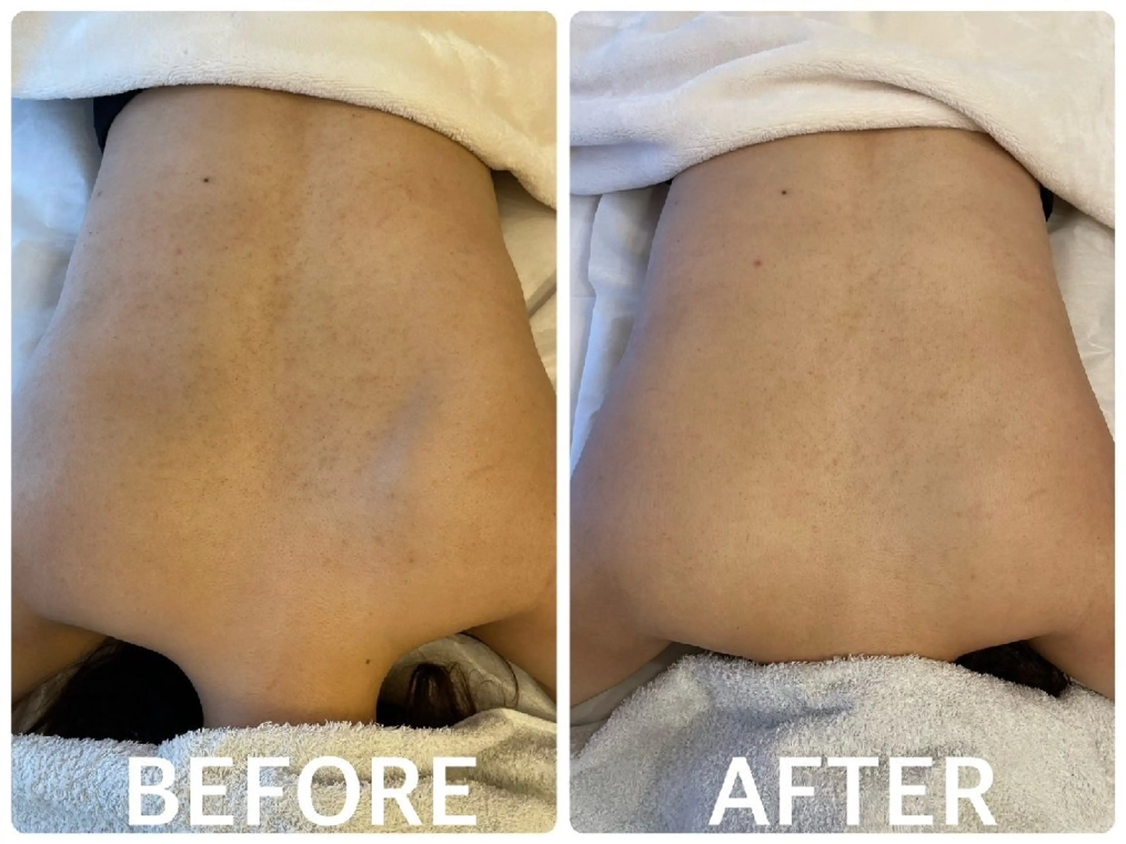 ハーブピーリング横浜 肌質改善専門店のその他イメージ