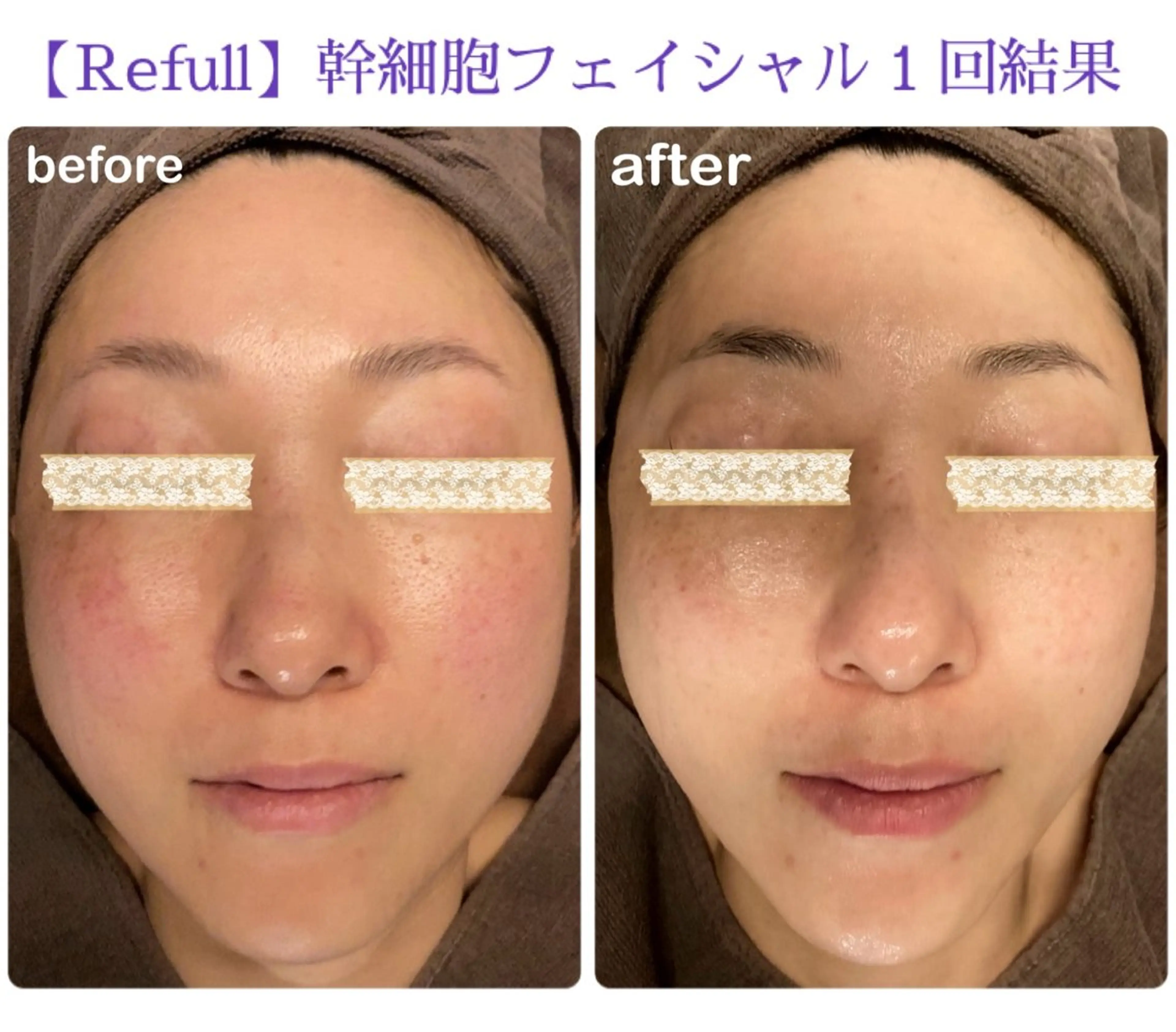 エステ リラク Refull (リフル)のエステ・リラクイメージ