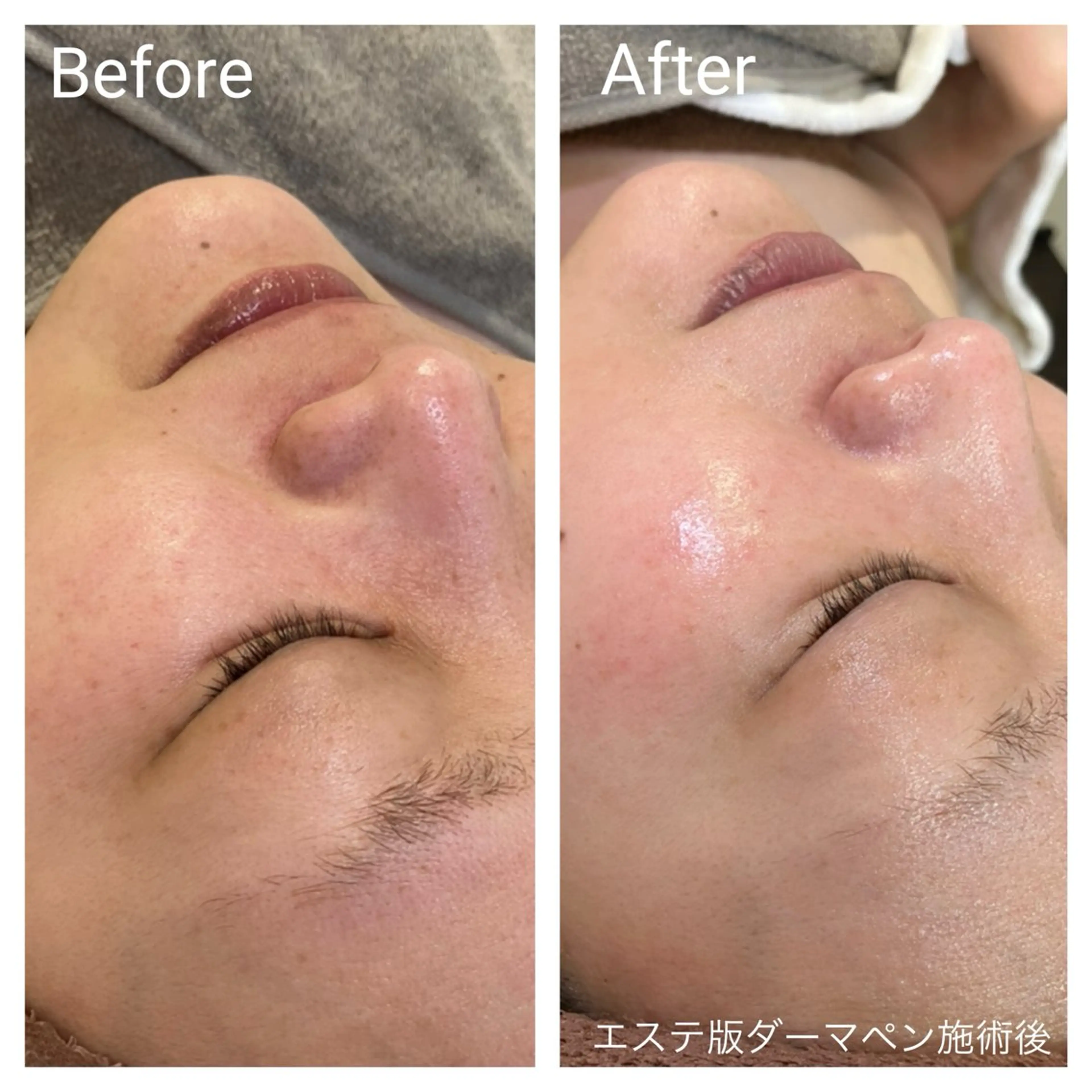 エステ 深い肌悩み&早期脱毛 完了サロンのエステ・リラクイメージ