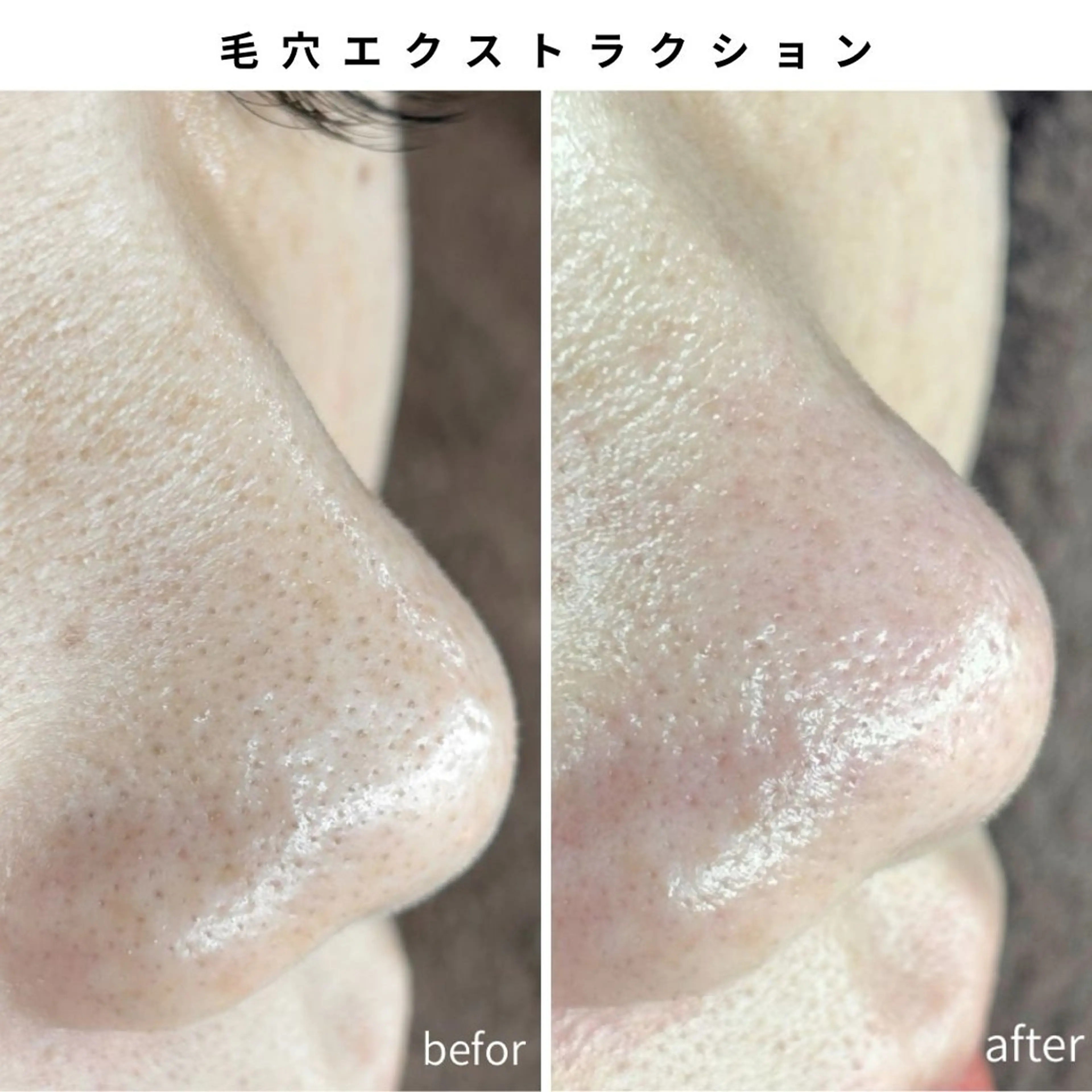 Muqu.所属・Muqu. 毛穴サロンのエステ・リラクイメージ