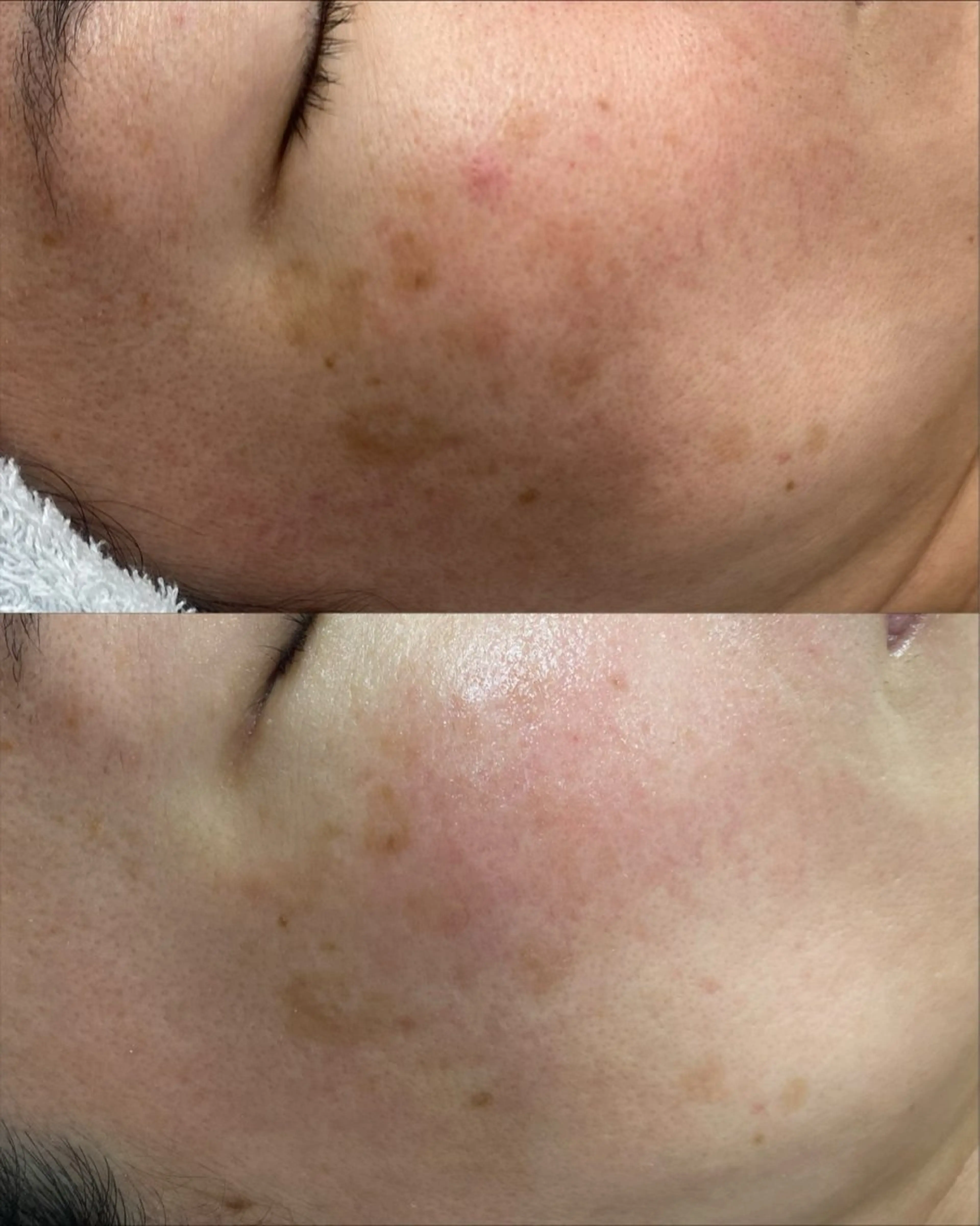 エステ CE salon Euluna所属・CE salon Eulunaのエステ・リラクイメージ