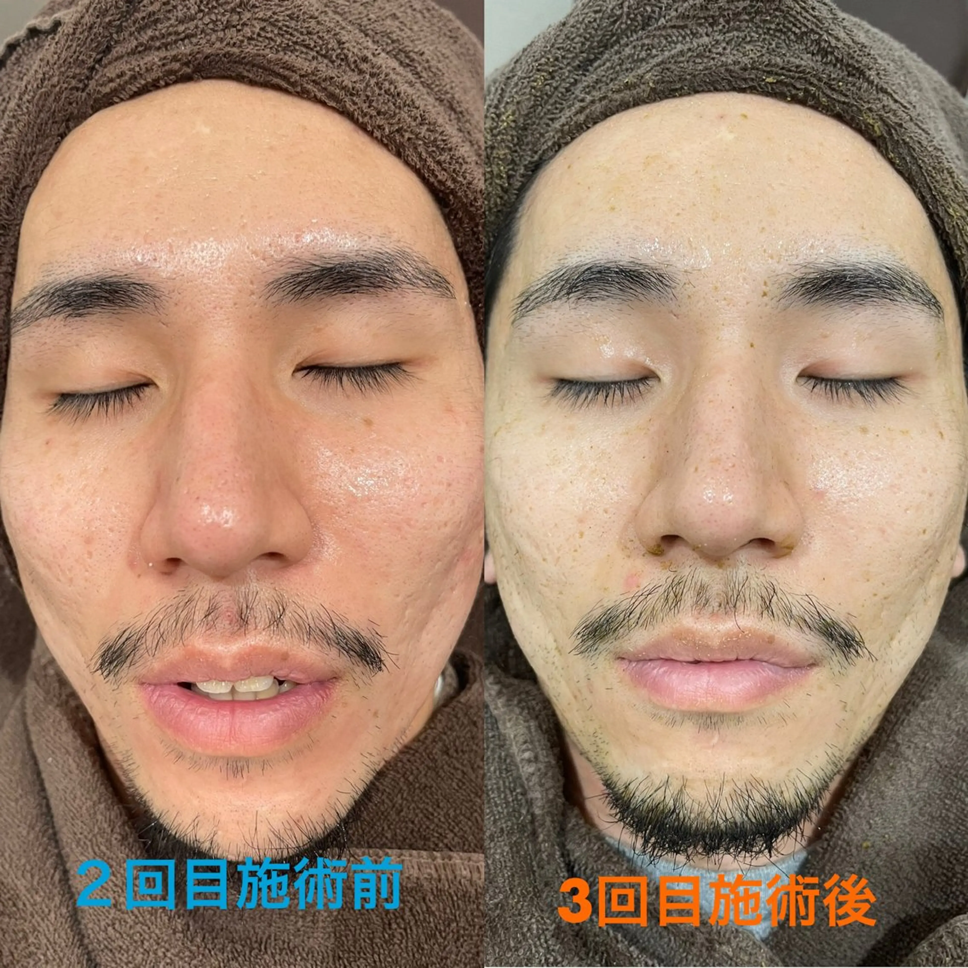 エステ vary  clue MISAのその他イメージ