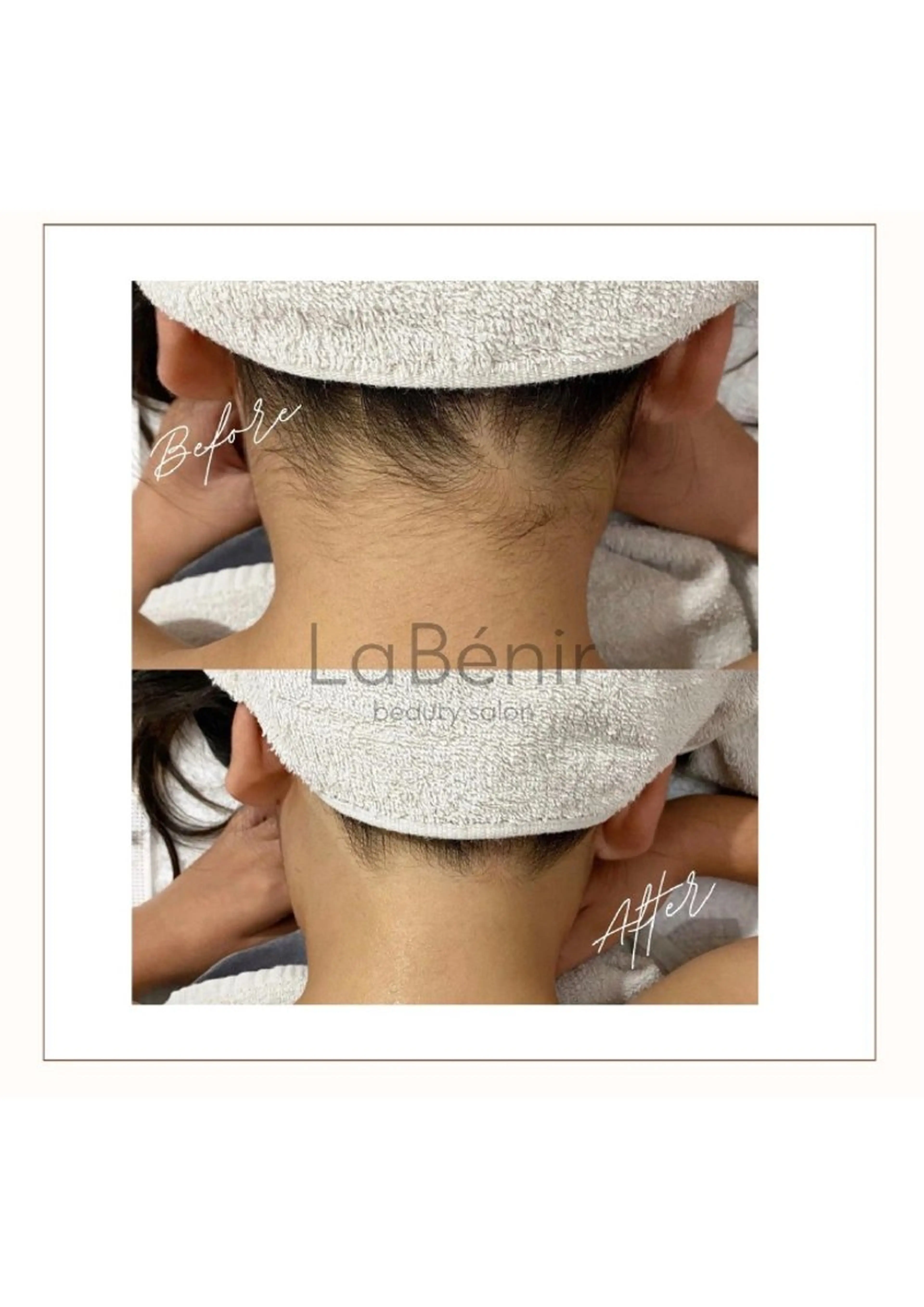 脱毛 脱毛/美肌【皮膚科看 護師経営】ラベニールのエステ・リラクイメージ