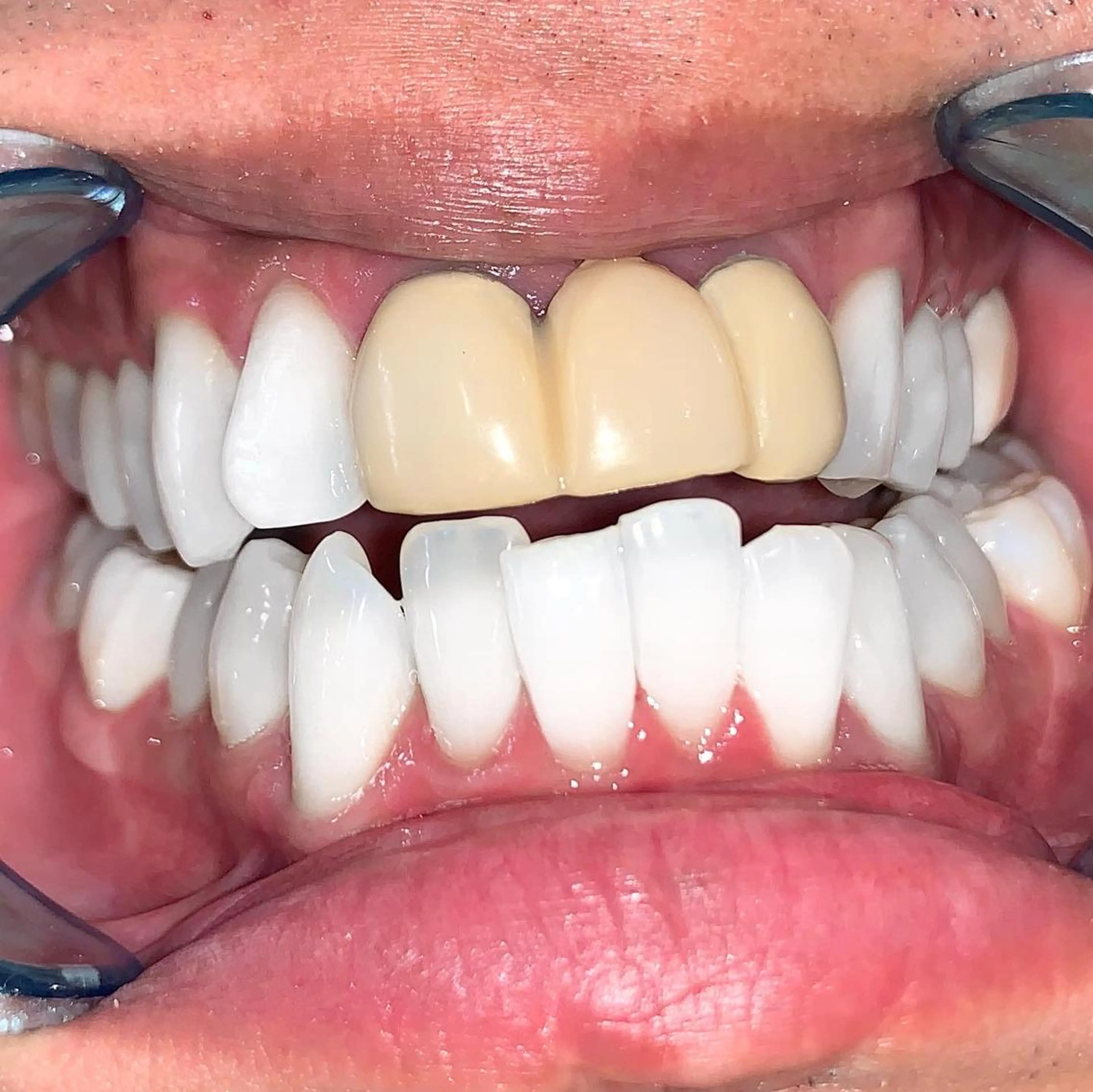 メンズ エステ リラク ライトビューティー 銀座店のエステ・リラクイメージ