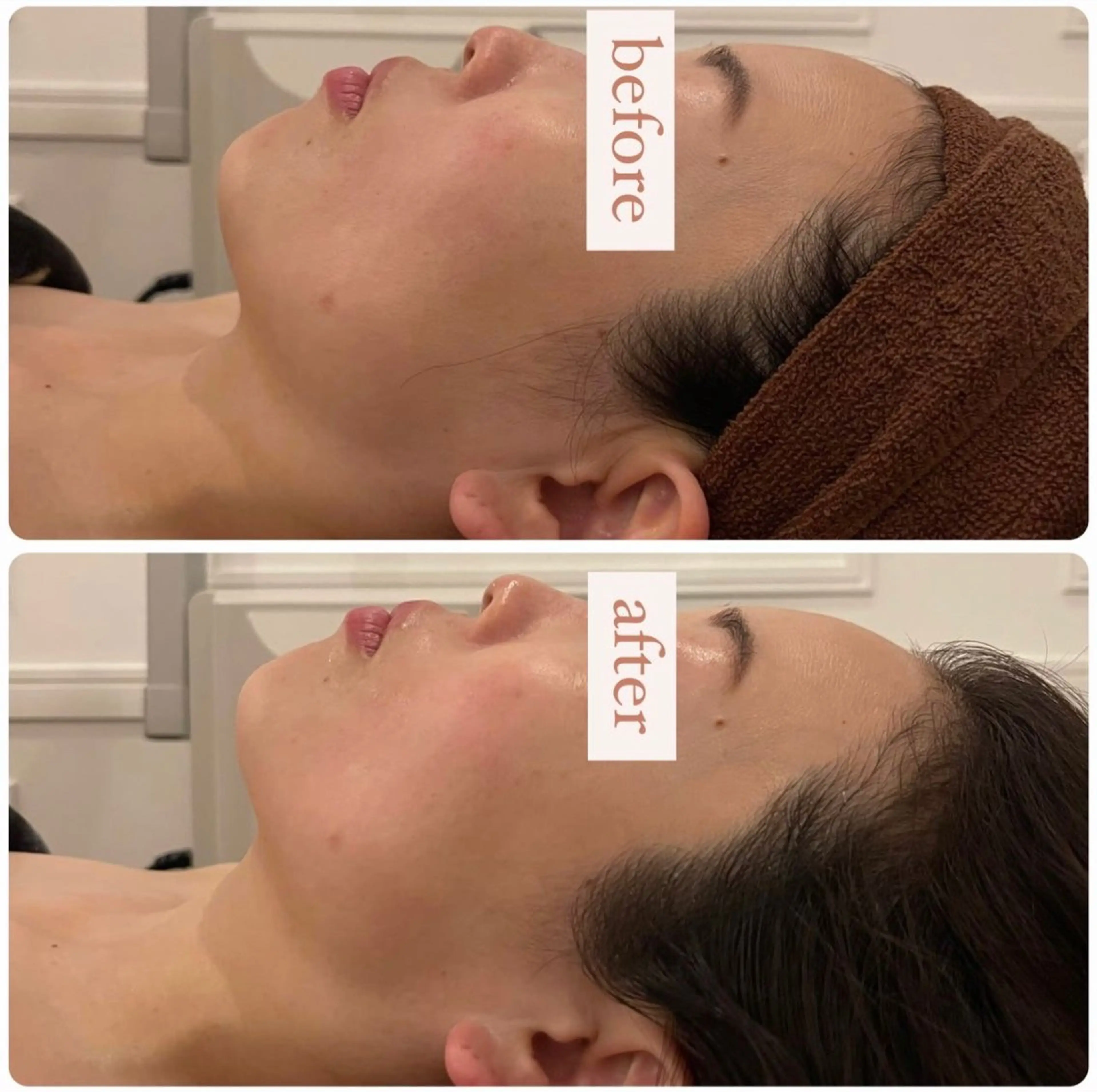 小顔ハイパーナイフ💆‍♀️筋膜リリースクリーム使用でデコルテもすっきり✨ヘッドスパ付きでたるみケア、眼精疲労も軽減✨の写真