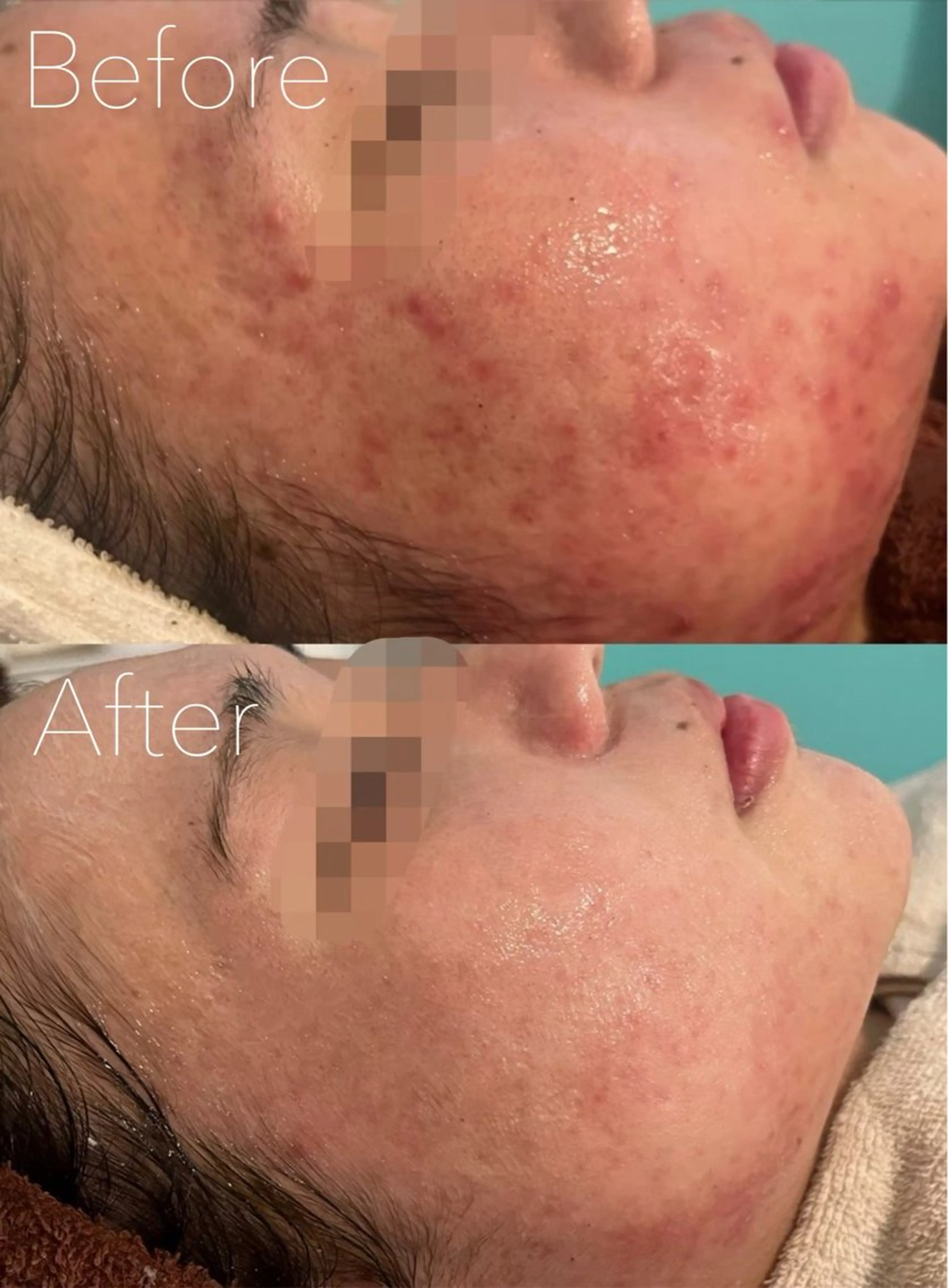 エステ 韓国肌管理 Belle 川越店のエステ・リラクイメージ