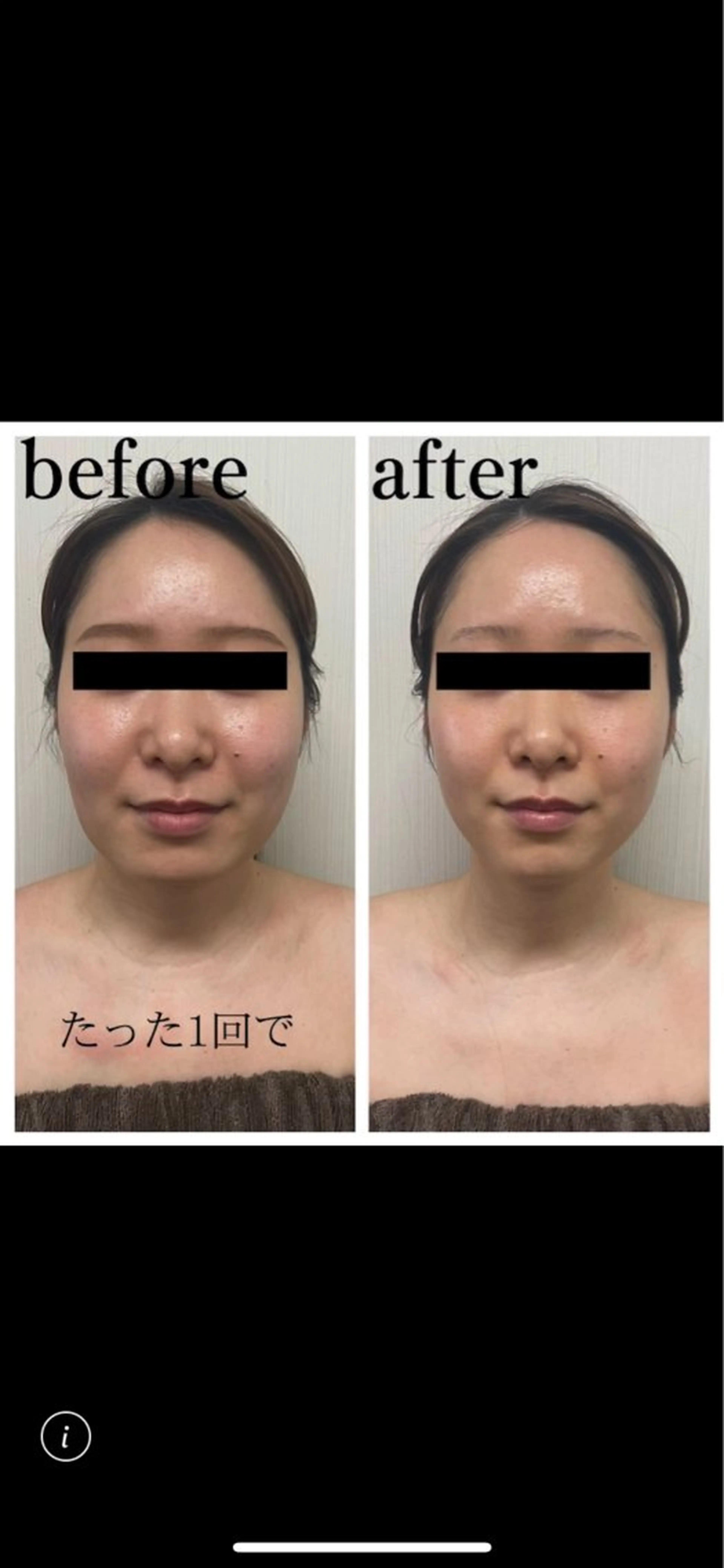 エステ リラク フェイシャルサロン オーガニックロハスのエステ・リラクイメージ