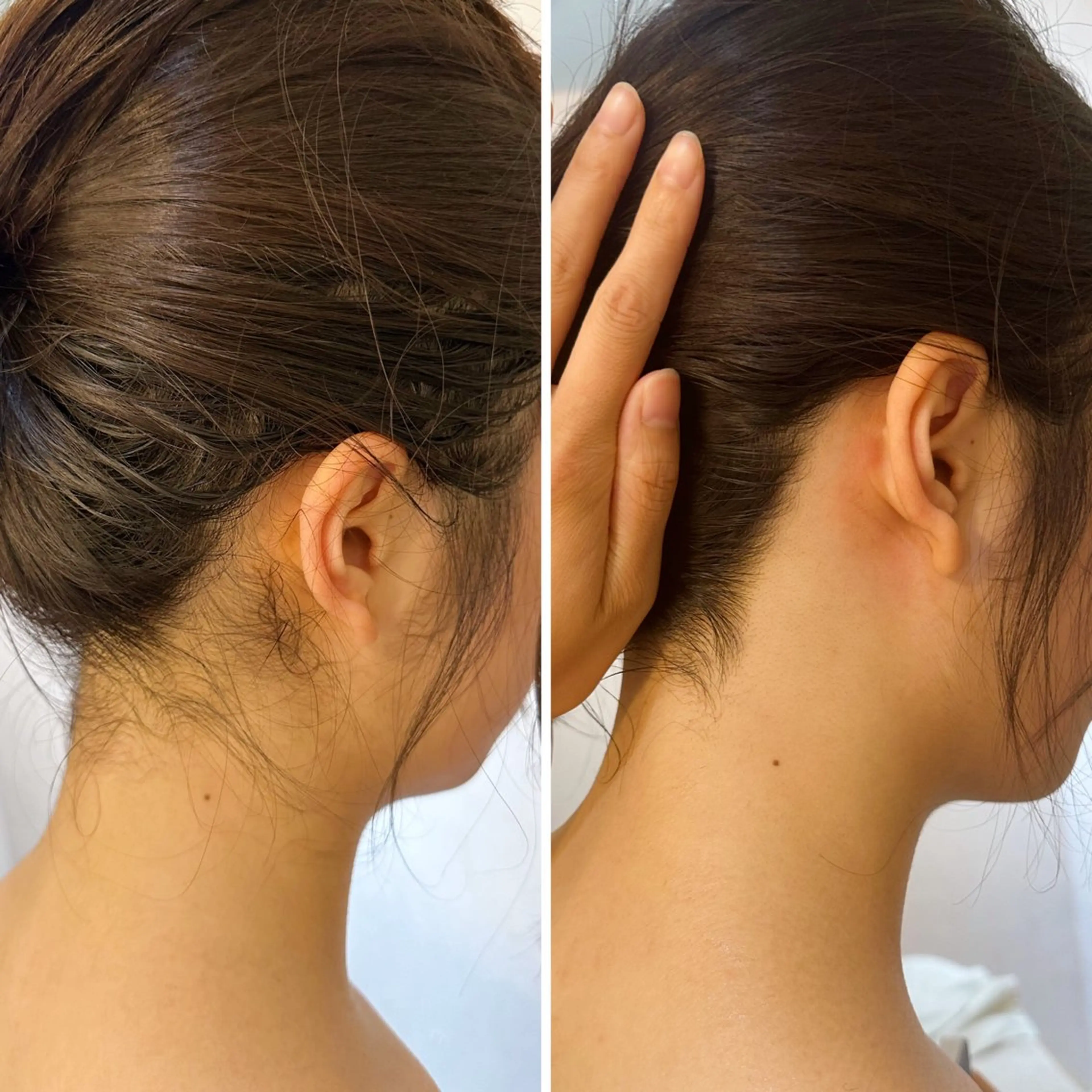 脱毛 うなじ脱毛/美肌脱毛 LABELのエステ・リラクイメージ