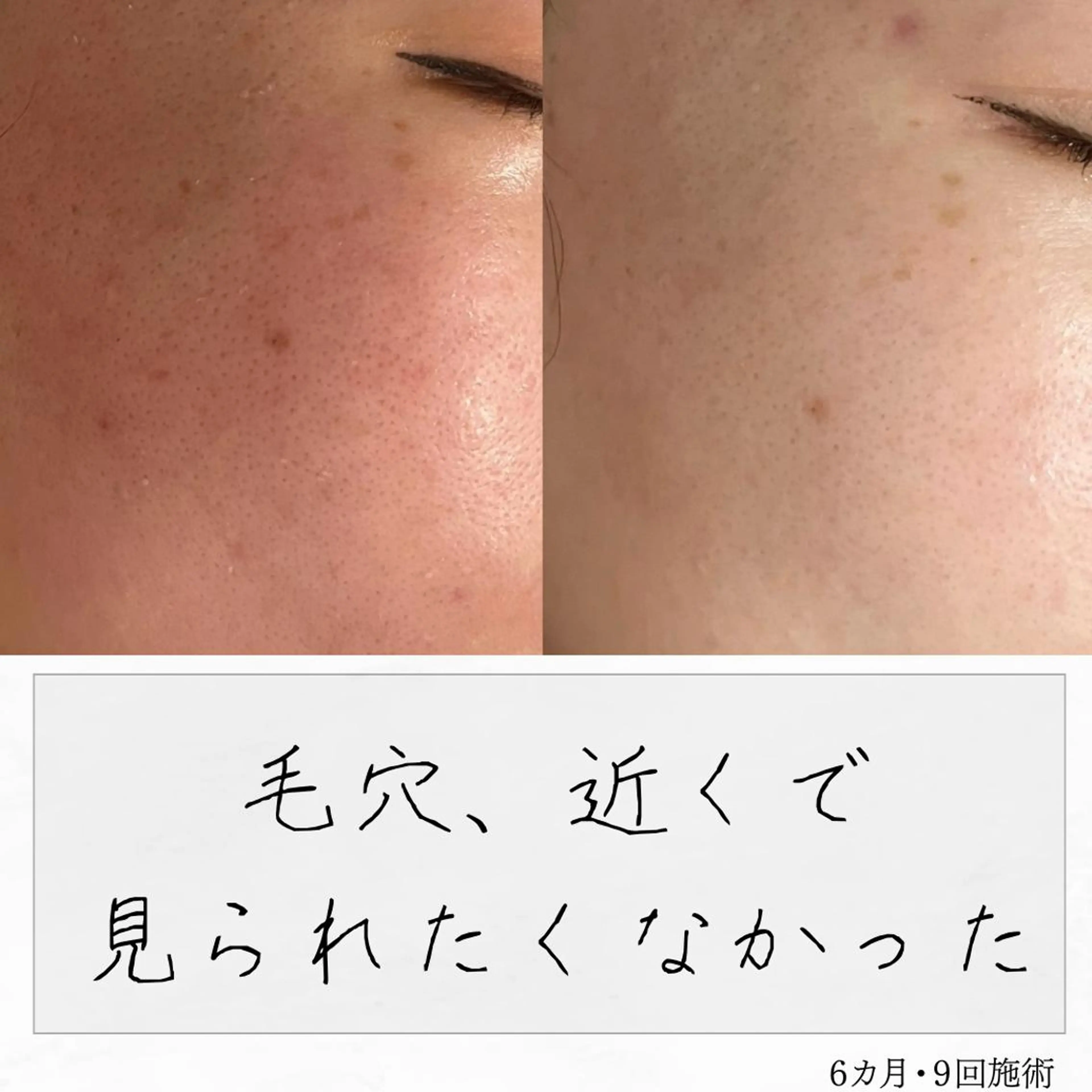 ニキビ経験者が施術 する専門サロン🌻のエステ・リラクイメージ