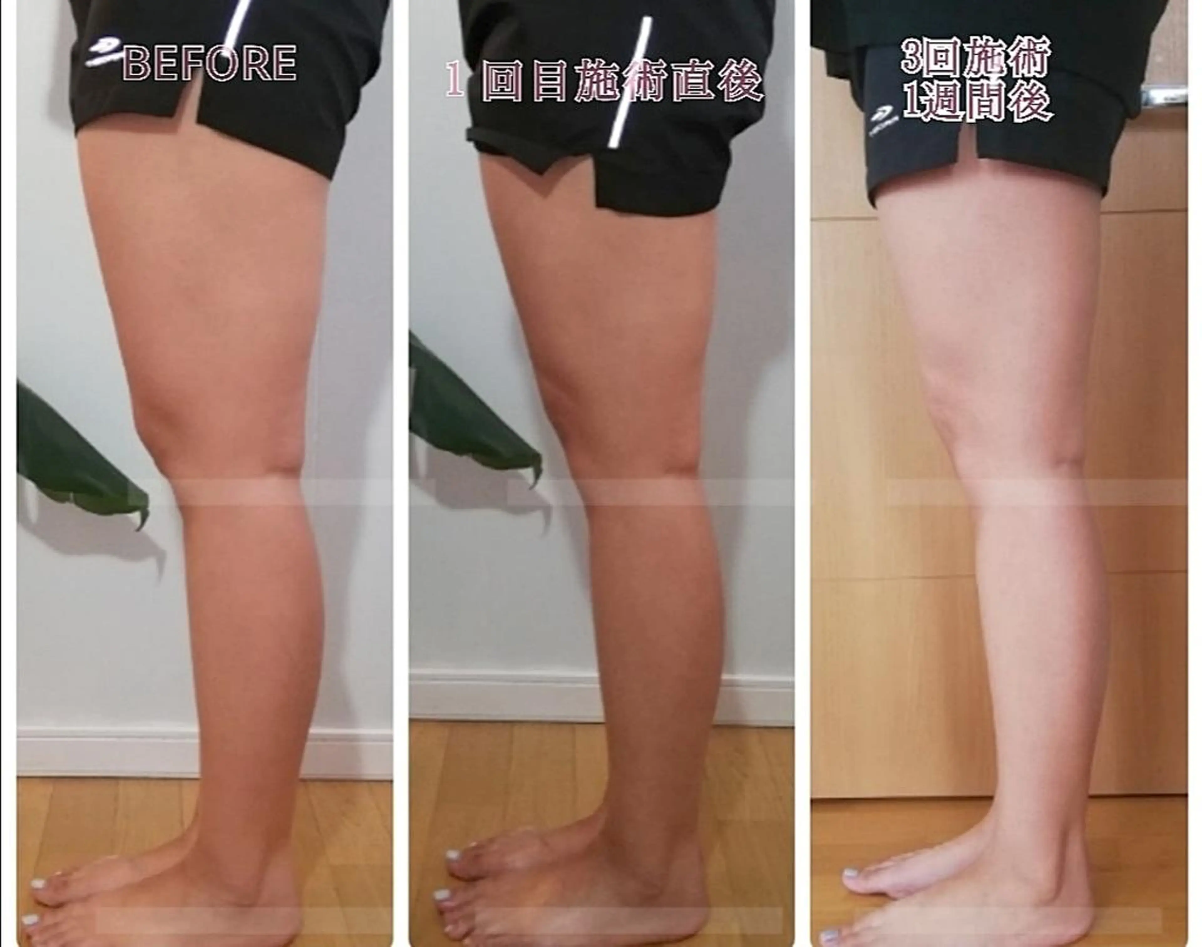 LATTE マツエク&ハイパーナイフ所属・LATTE eyelashのマツエク・マツパデザイン