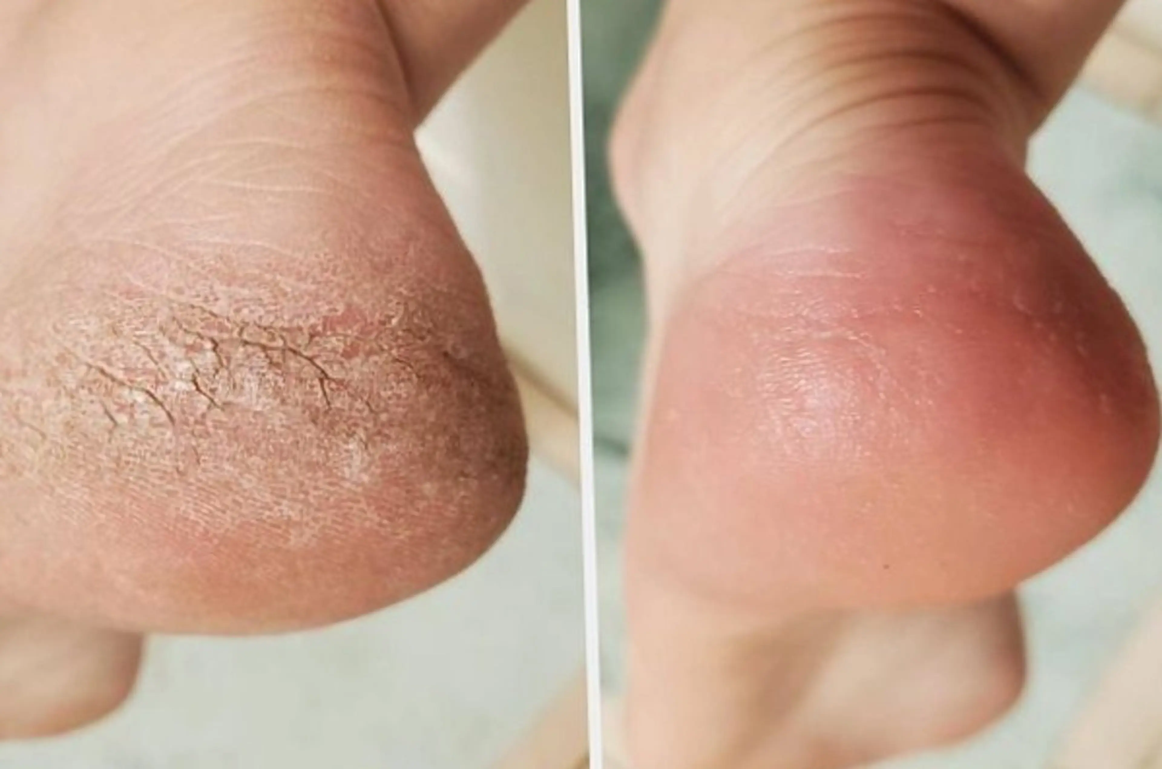 ネイル フットネイル HerNails  Yokosukaのネイルデザイン