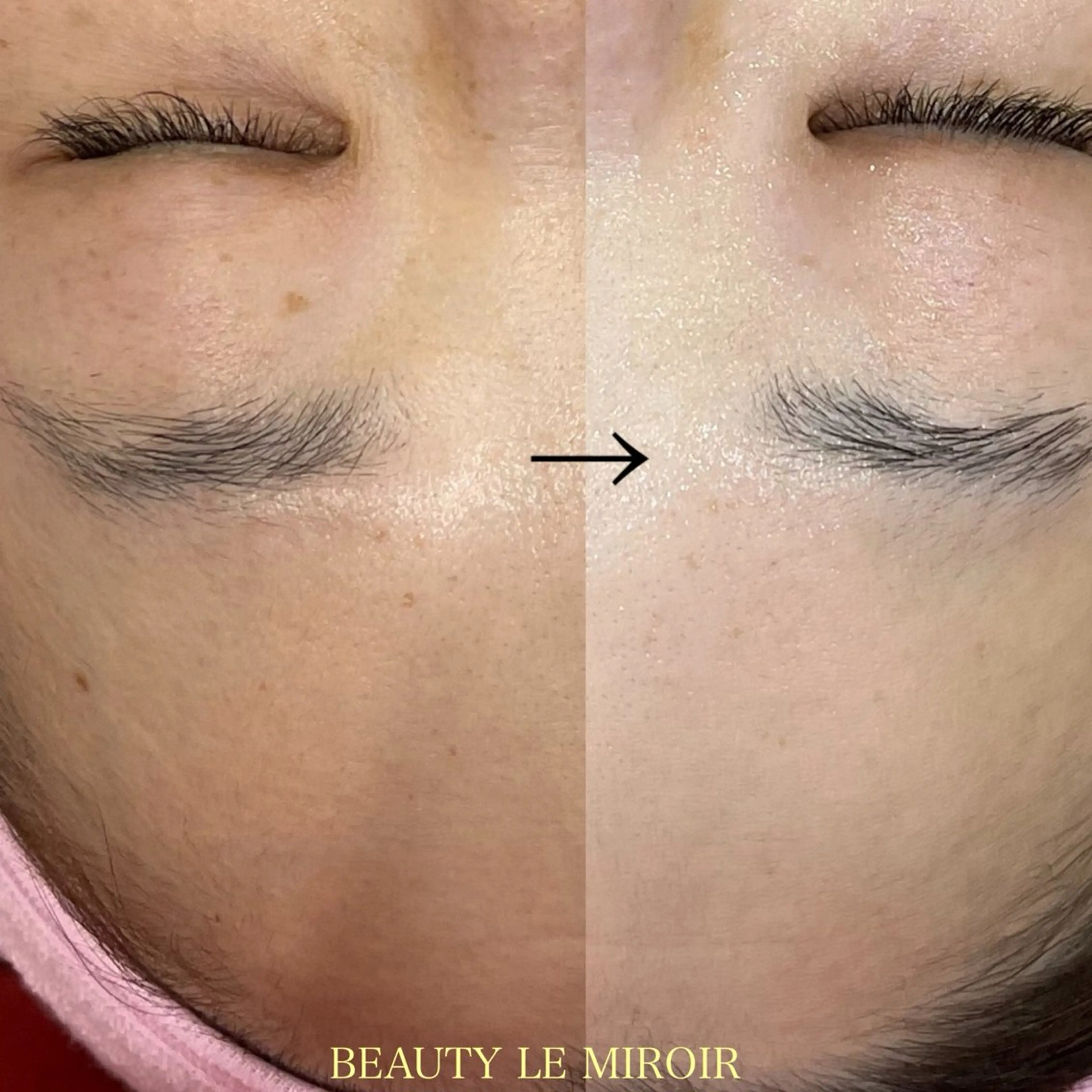 エステ ビューティー ミロワールのエステ・リラクイメージ