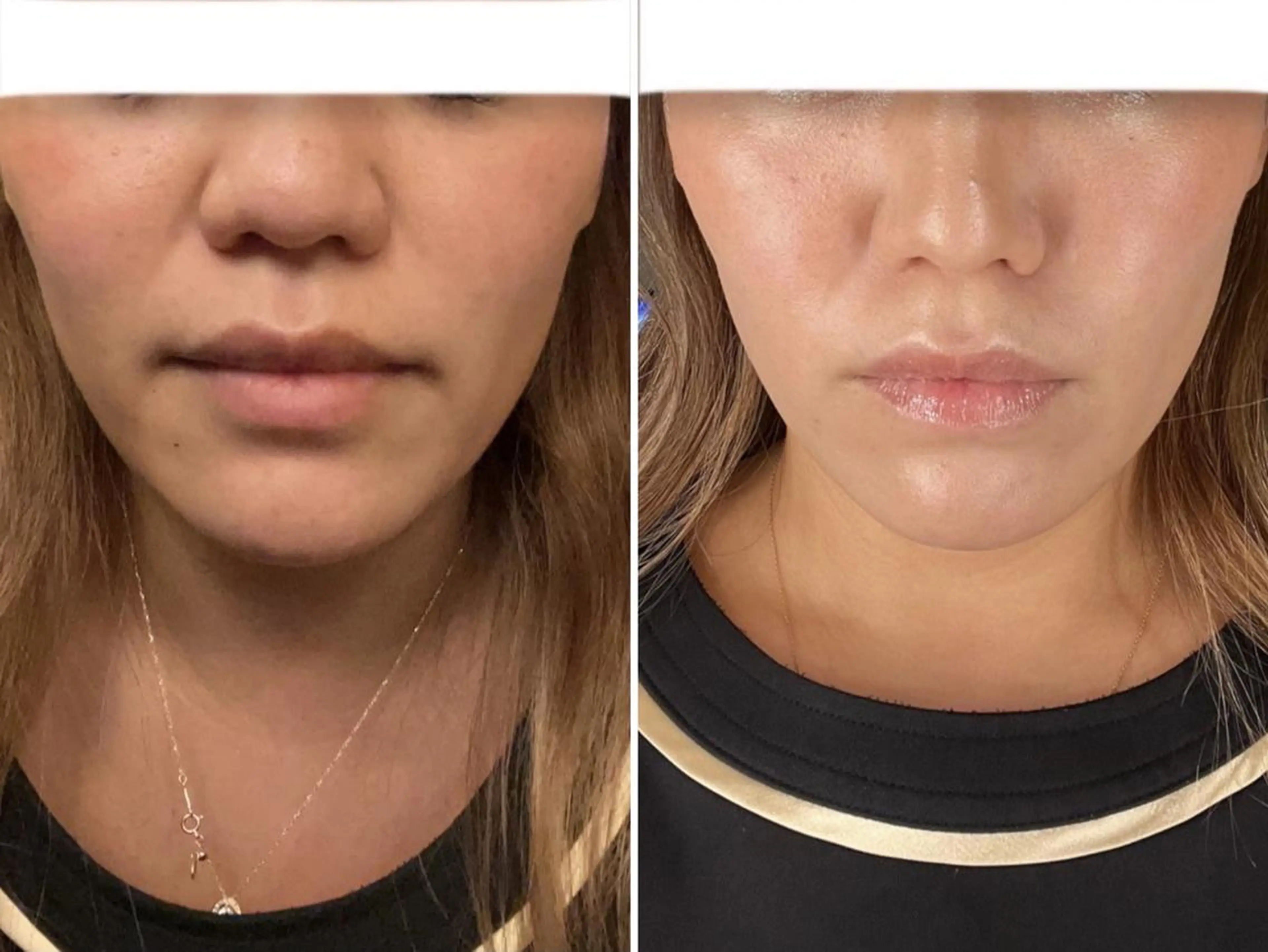 アイブロウ Epina 千葉店 【エピナ】のエステ・リラクイメージ