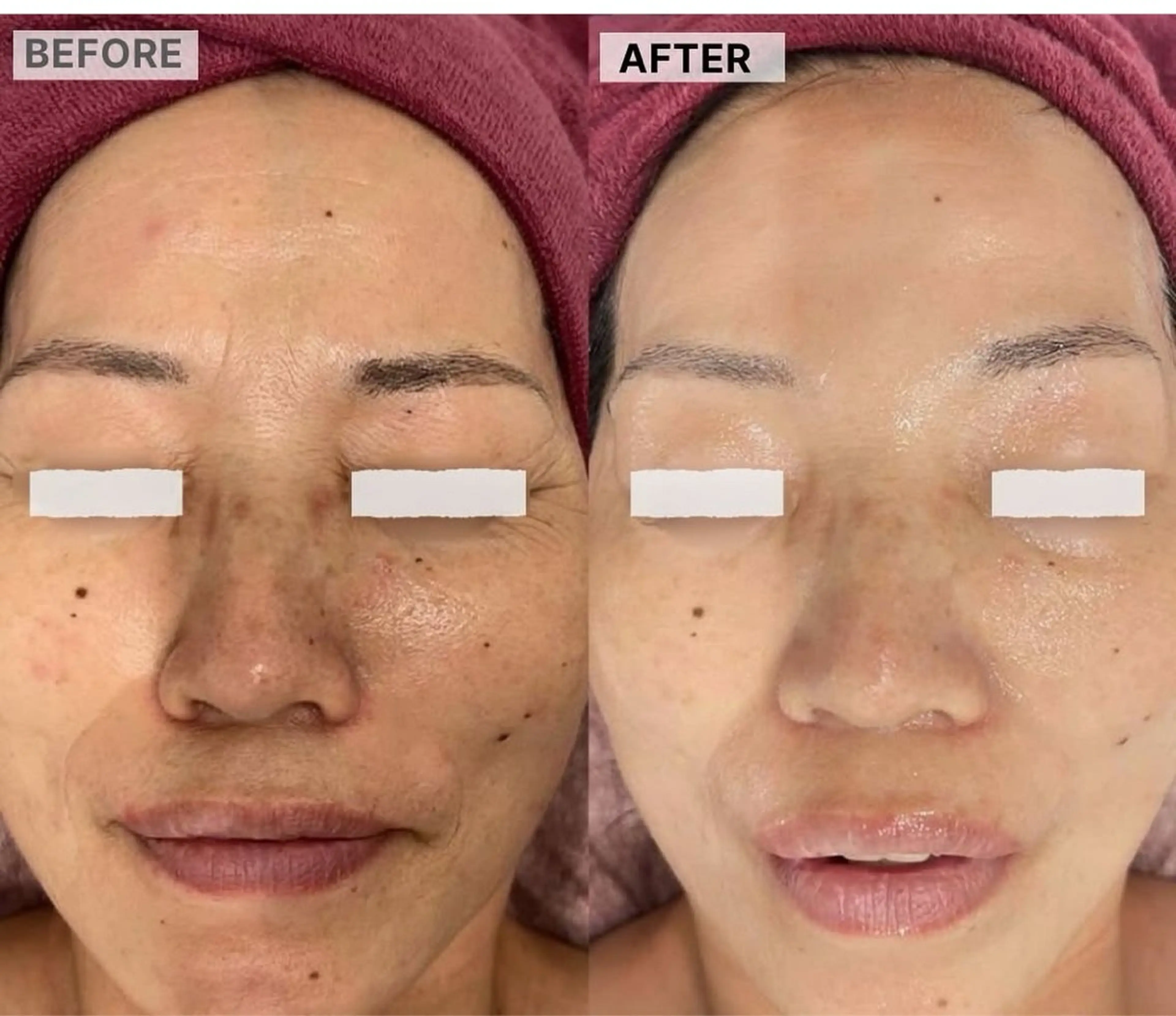 韓国最新エステ美肌ケアの写真