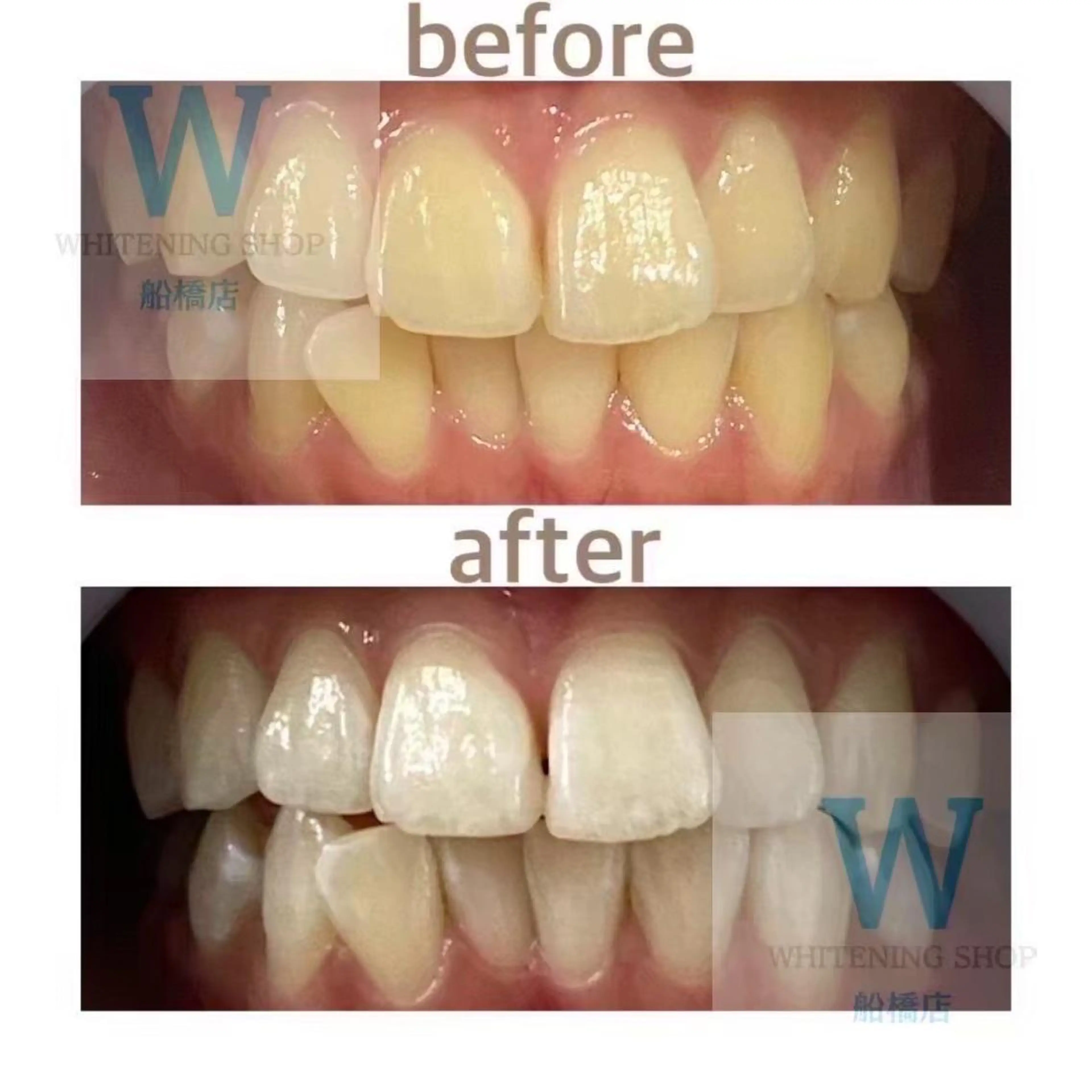 ホワイトニング ショップ船橋店🦷のエステ・リラクイメージ