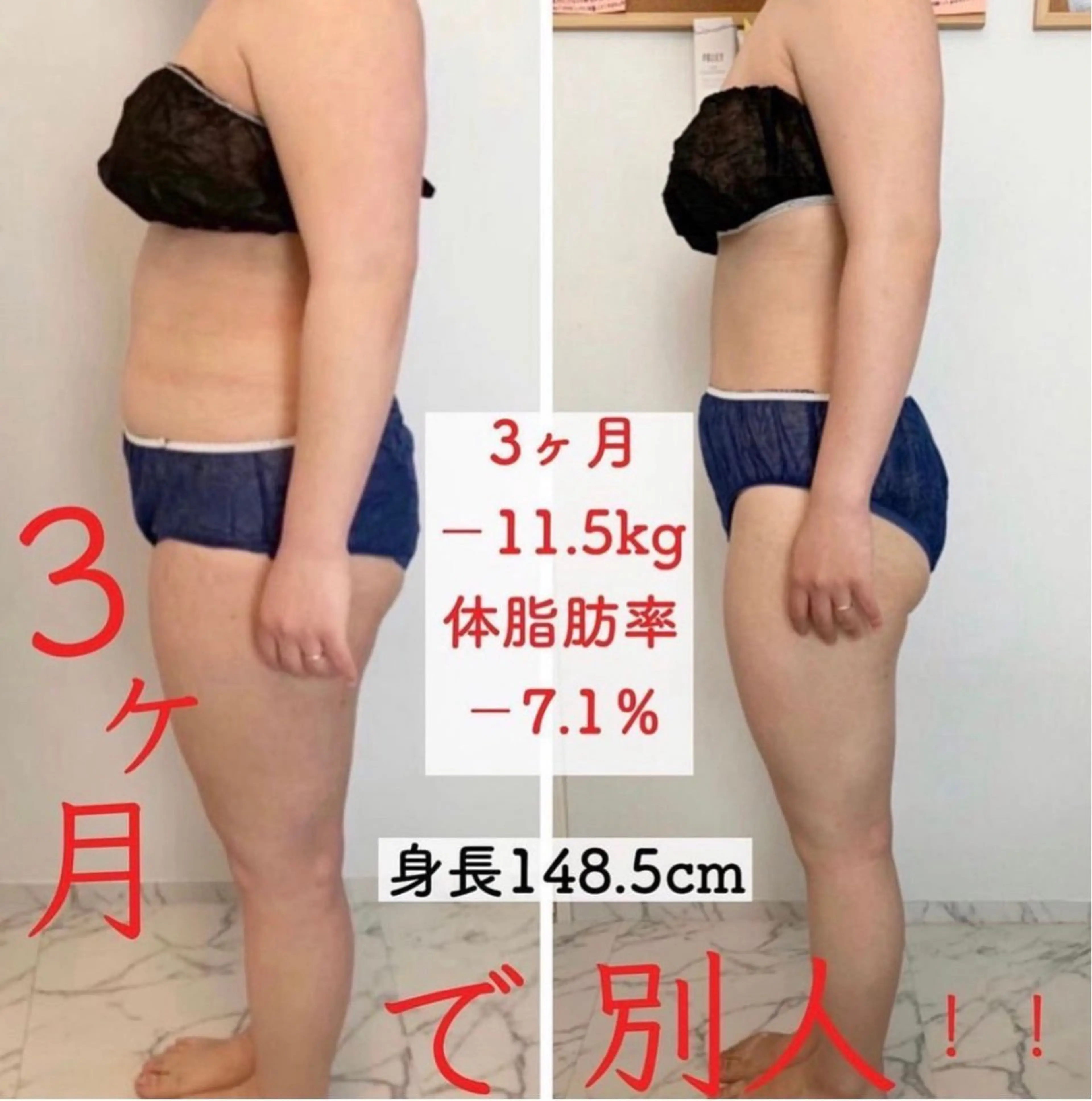 イヤーセラミックダイエットカウンセリングの写真