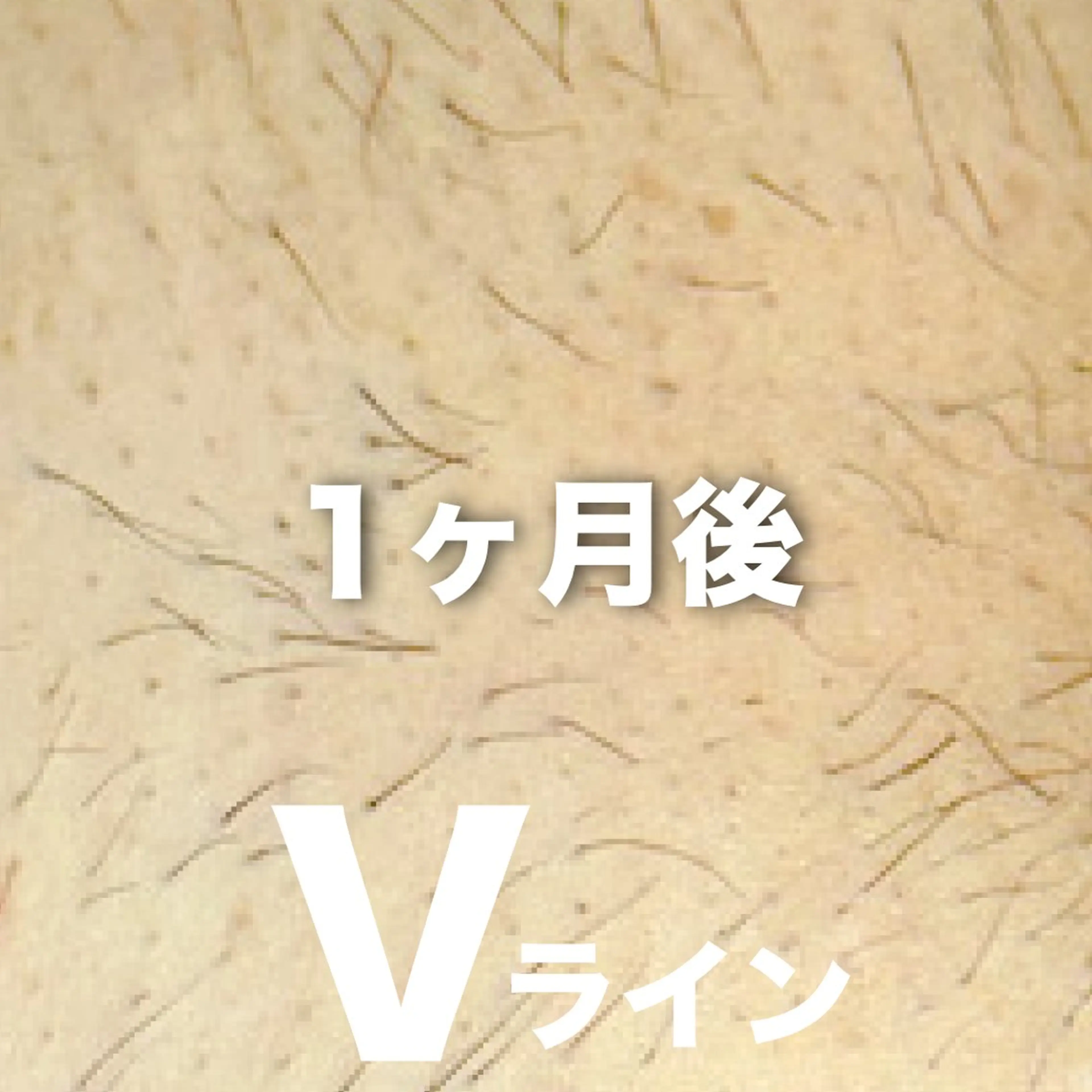 Hitomi シュガーリング豊橋のその他イメージ