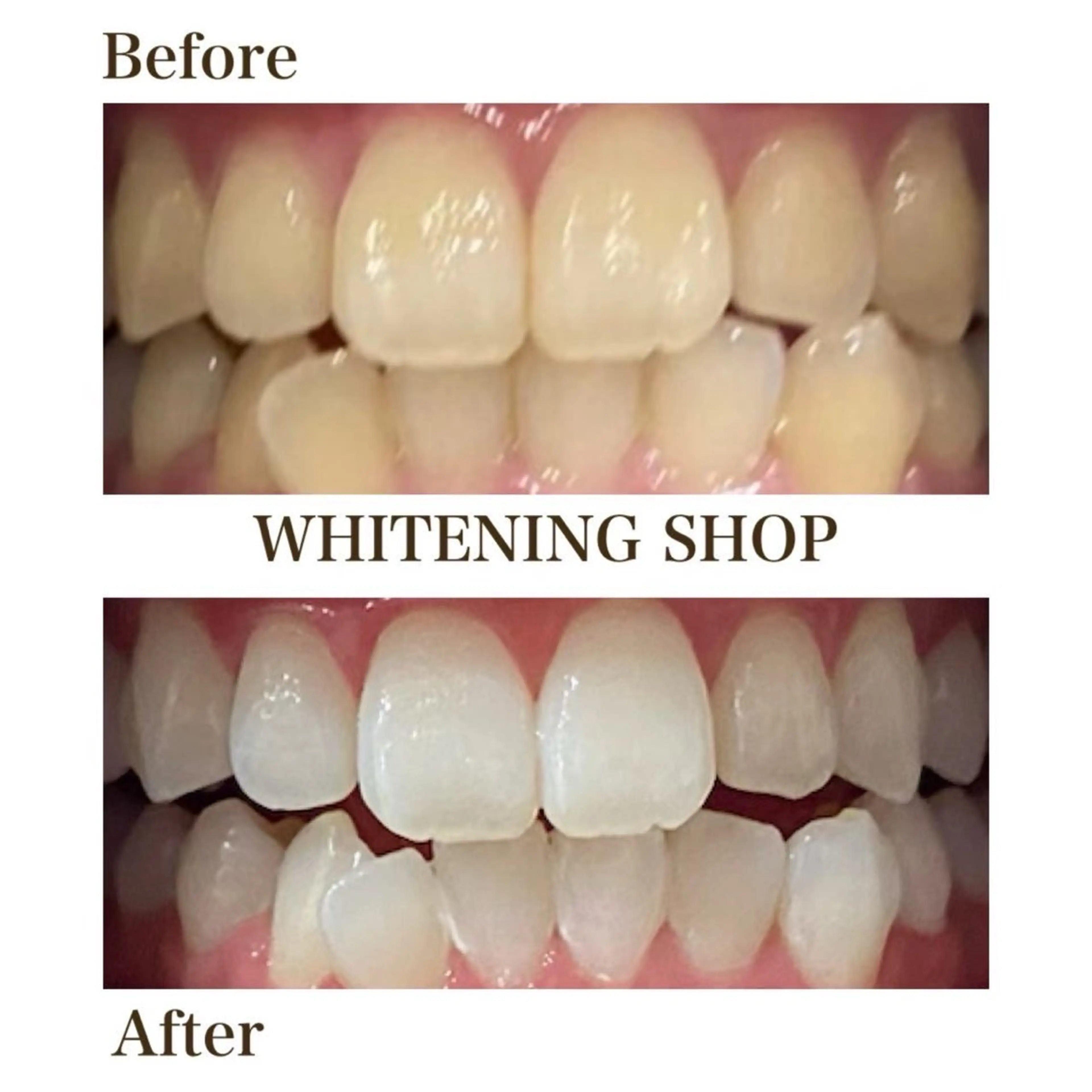 その他 ホワイトニング ショップ津店のその他イメージ