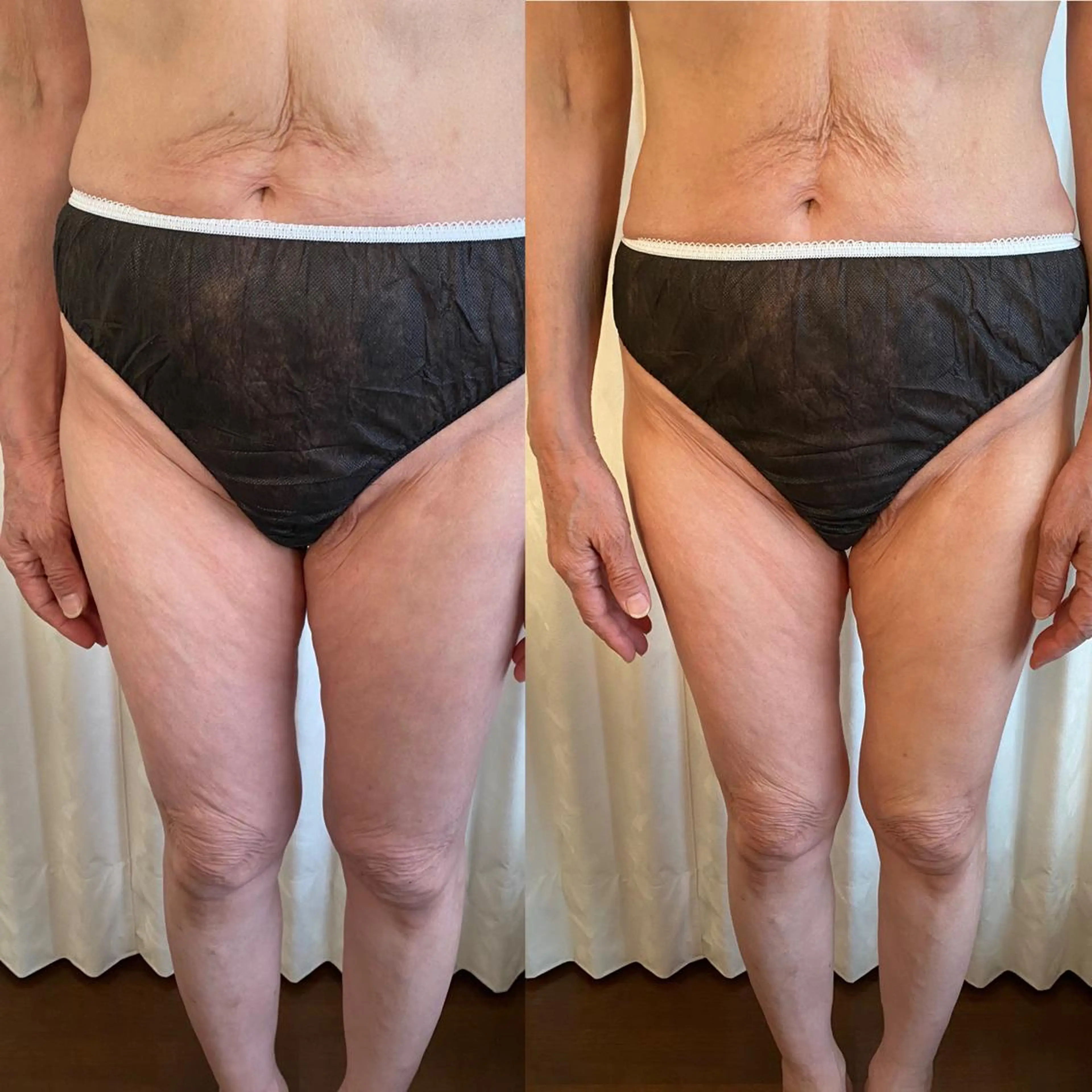 R E O T I A R A（レオティアラ）所属・高屋 昌子のその他イメージ