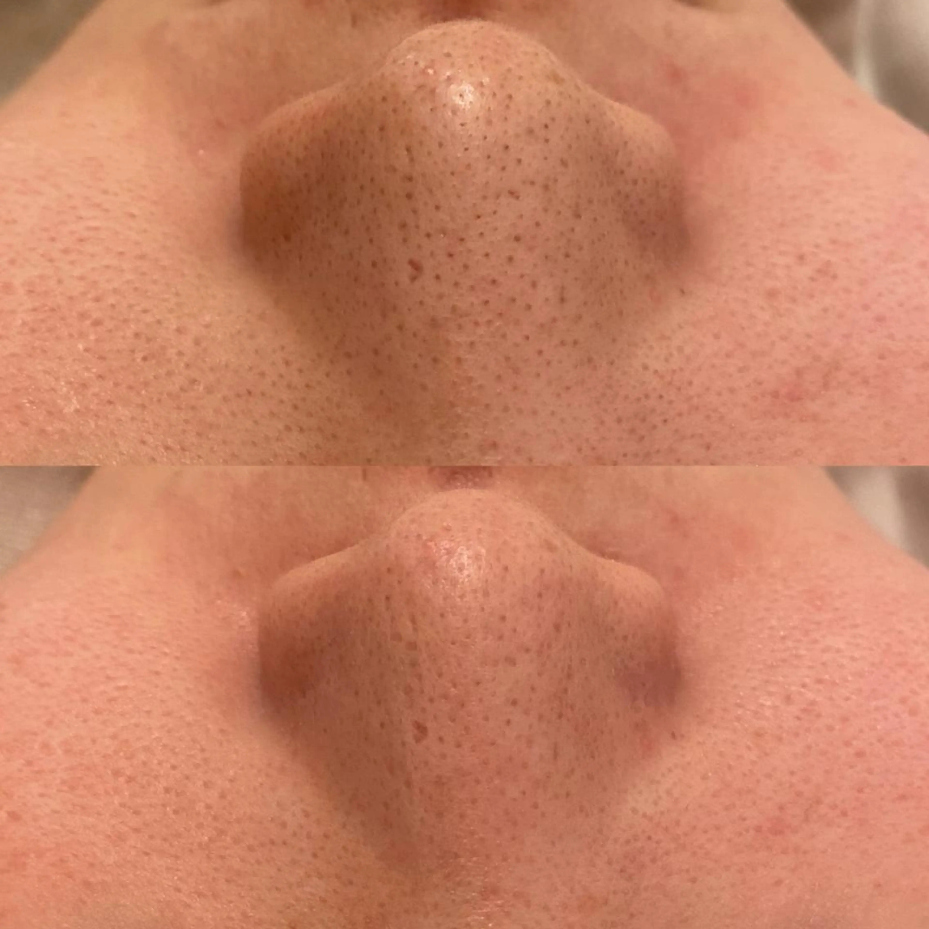 ララ/ハーブ メゾンリュバンのエステ・リラクイメージ