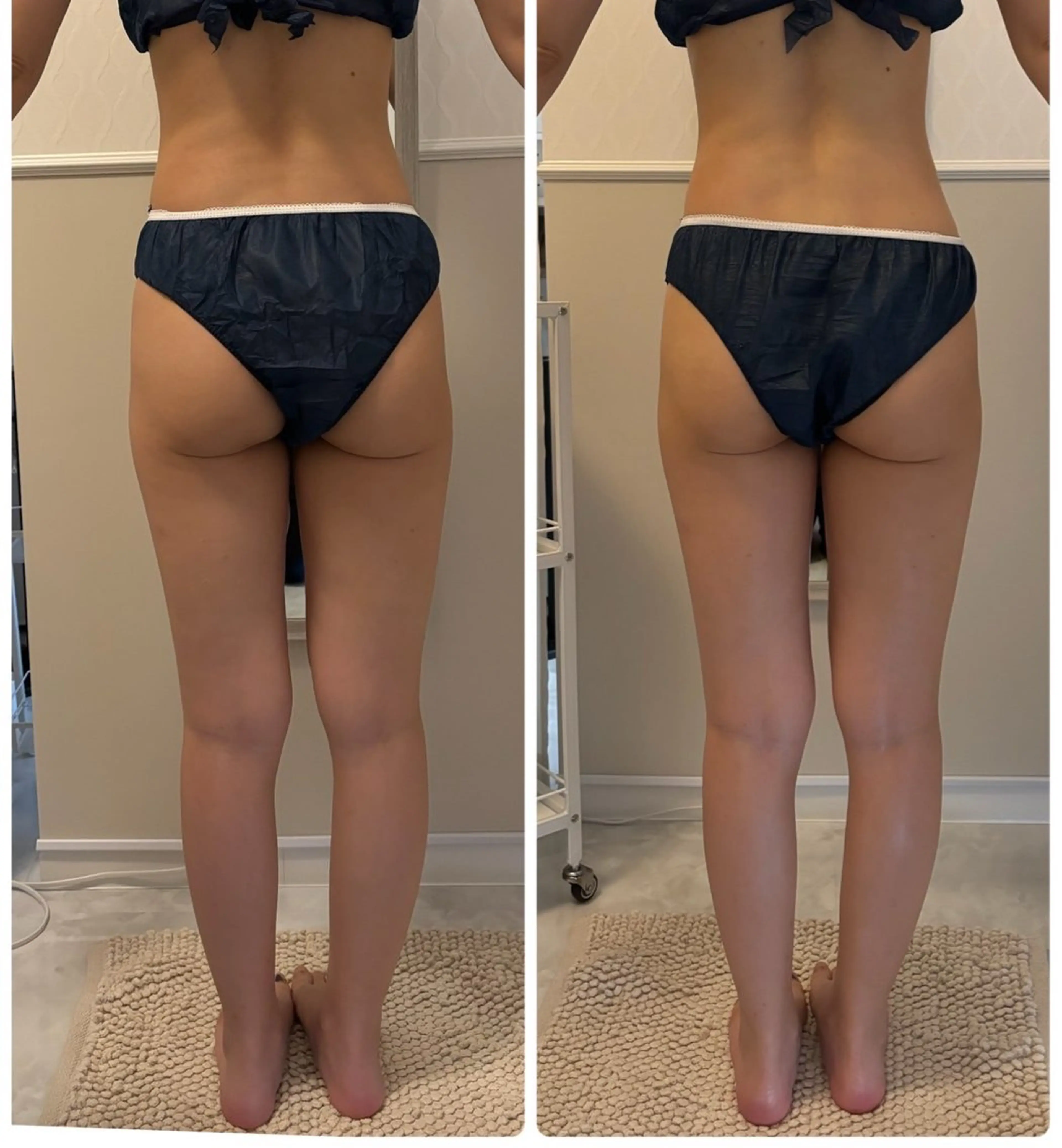 小顔美肌痩身サロン Ranのその他イメージ