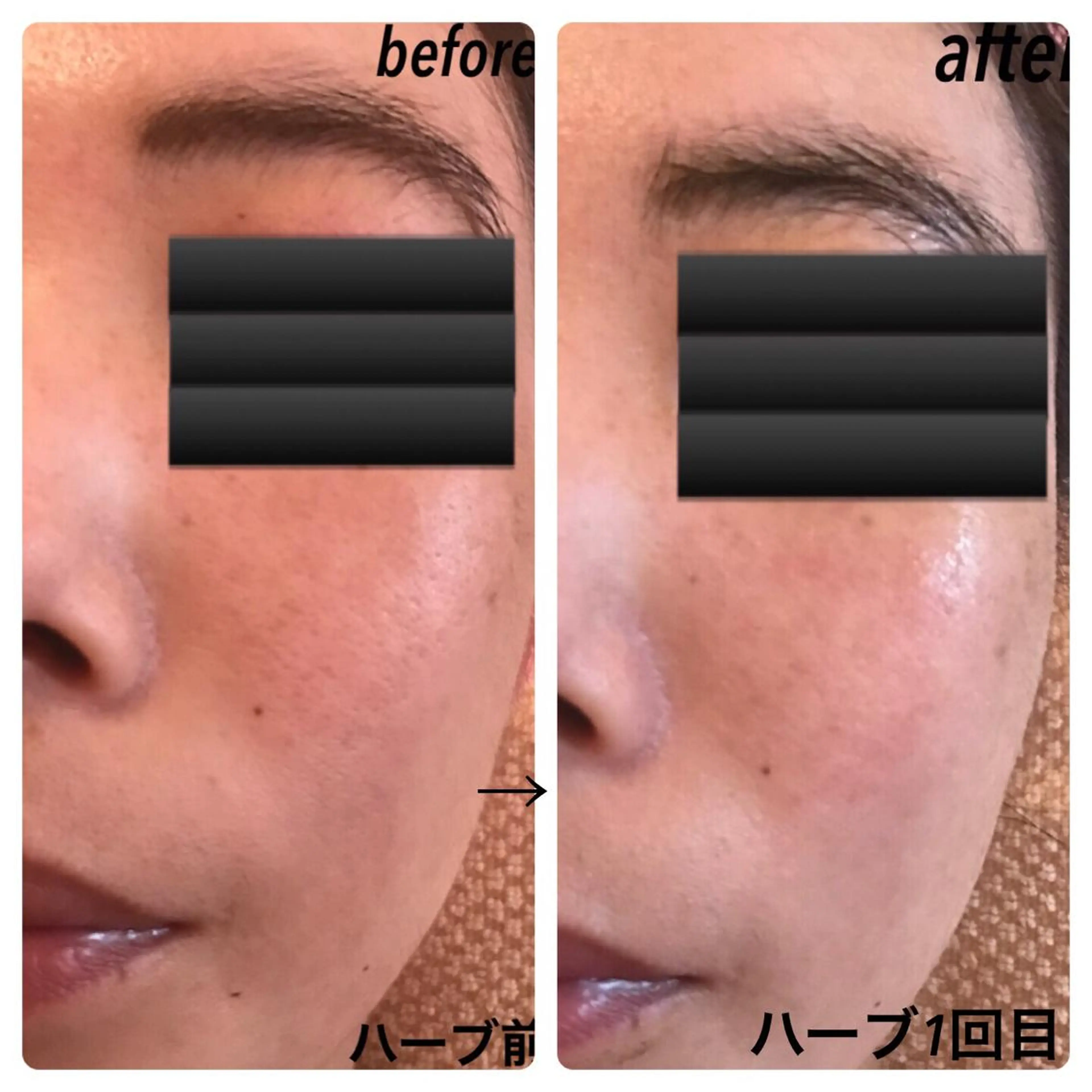 fairyrose organicエステのエステ・リラクイメージ