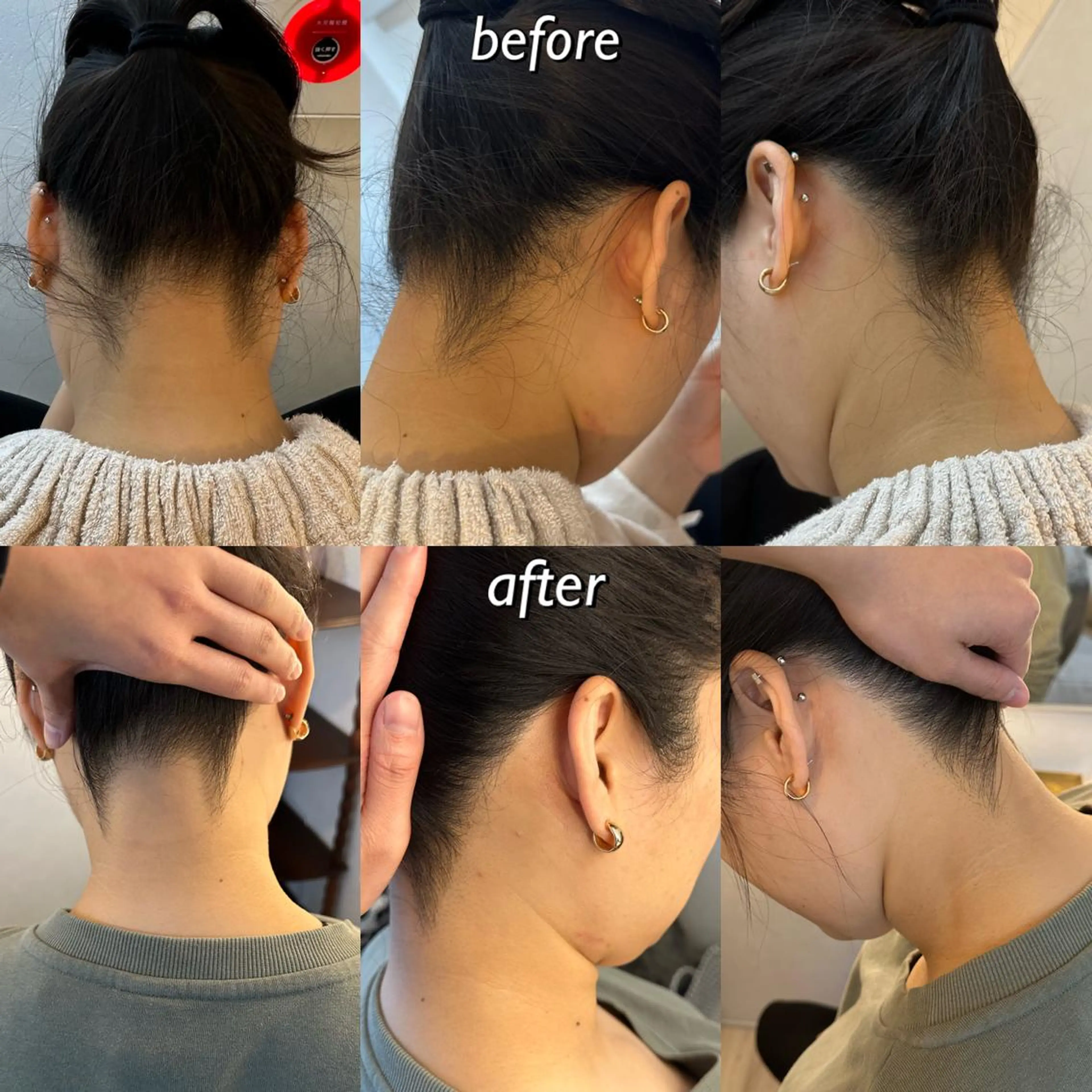 うなじ脱毛/美肌脱毛 LABELのエステ・リラクイメージ