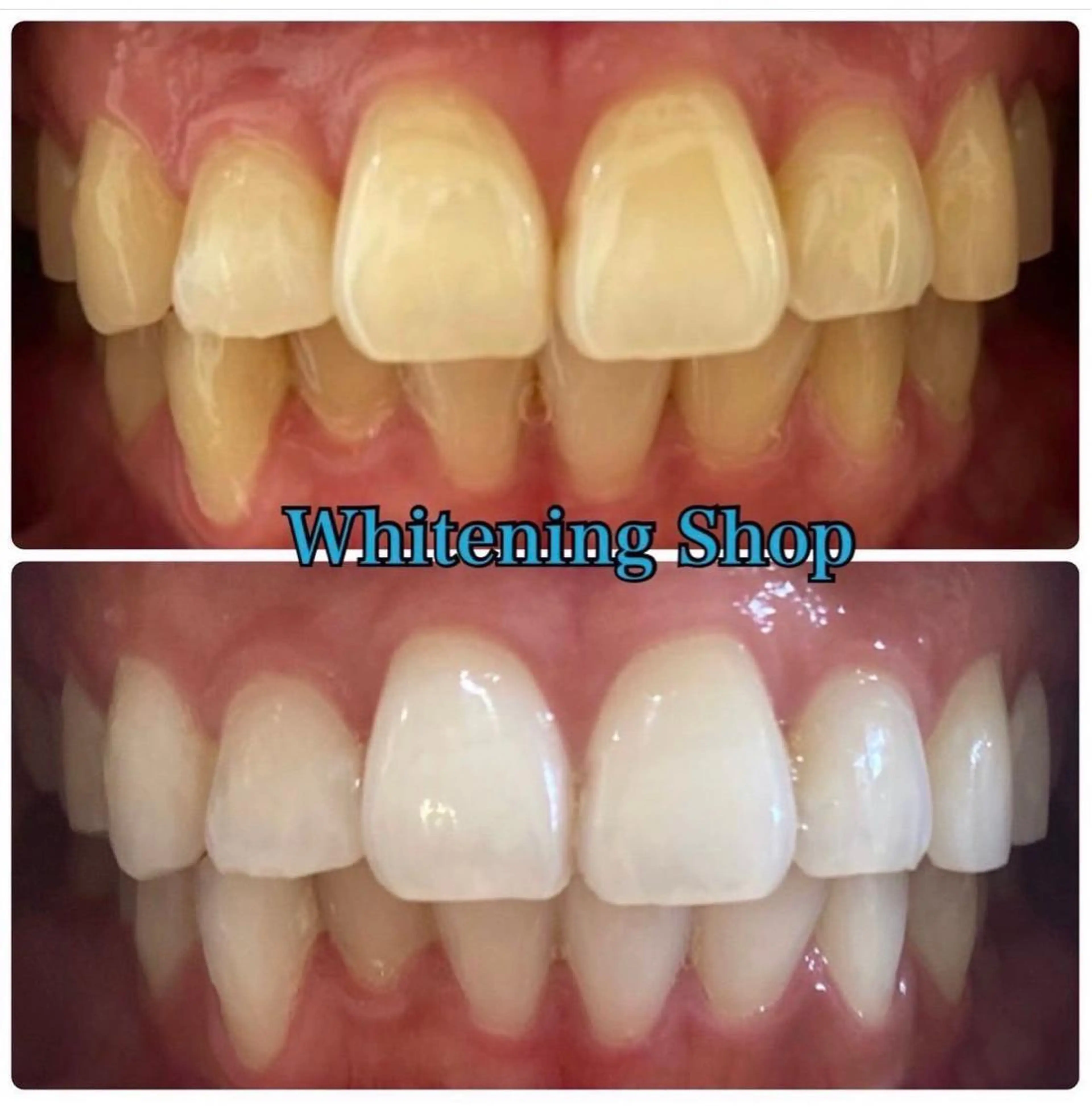 ホワイトニング ショップ吉祥寺店のエステ・リラクイメージ