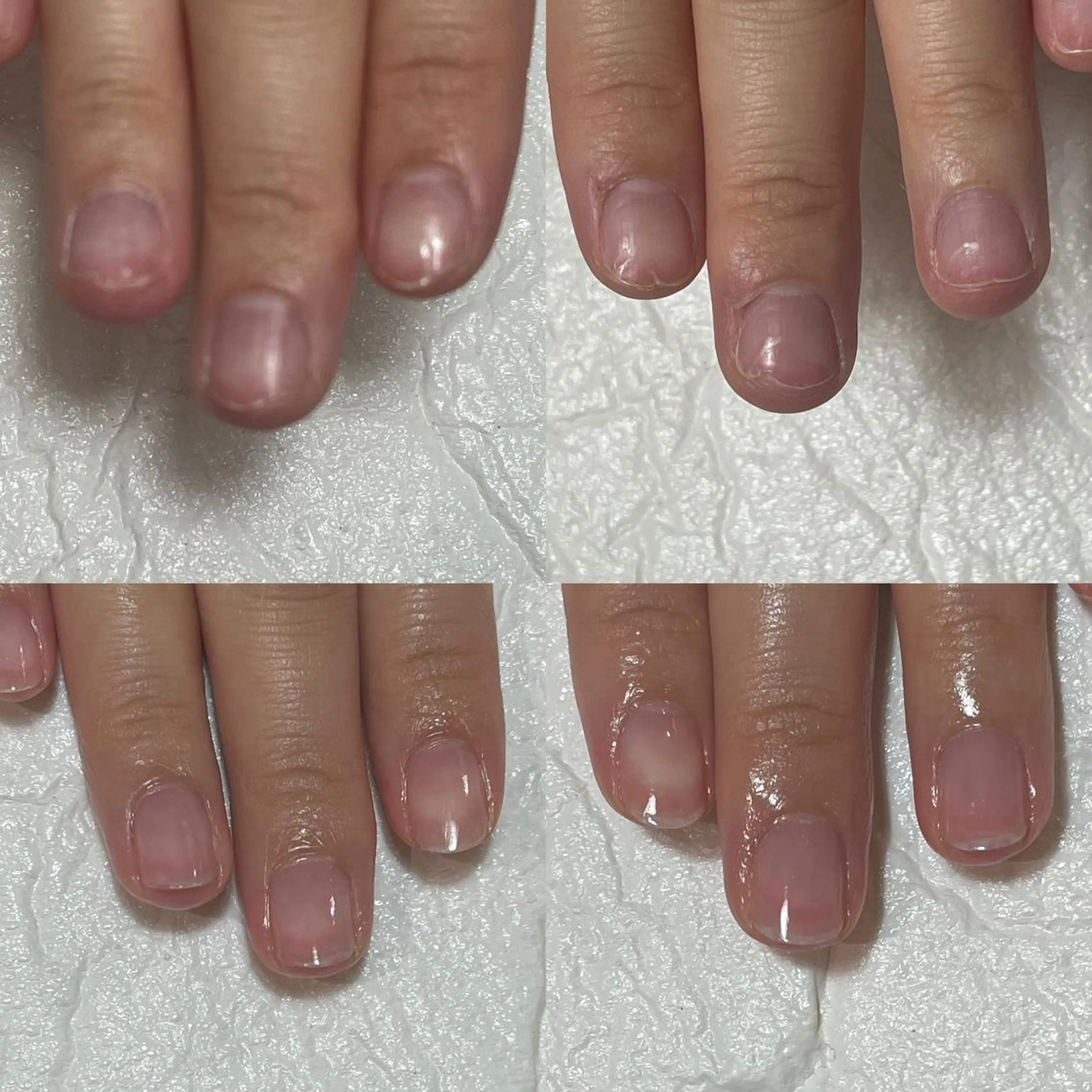 ネイル ジェルネイル 自爪育成・巻き爪 補正講師　津蔵のネイルデザイン