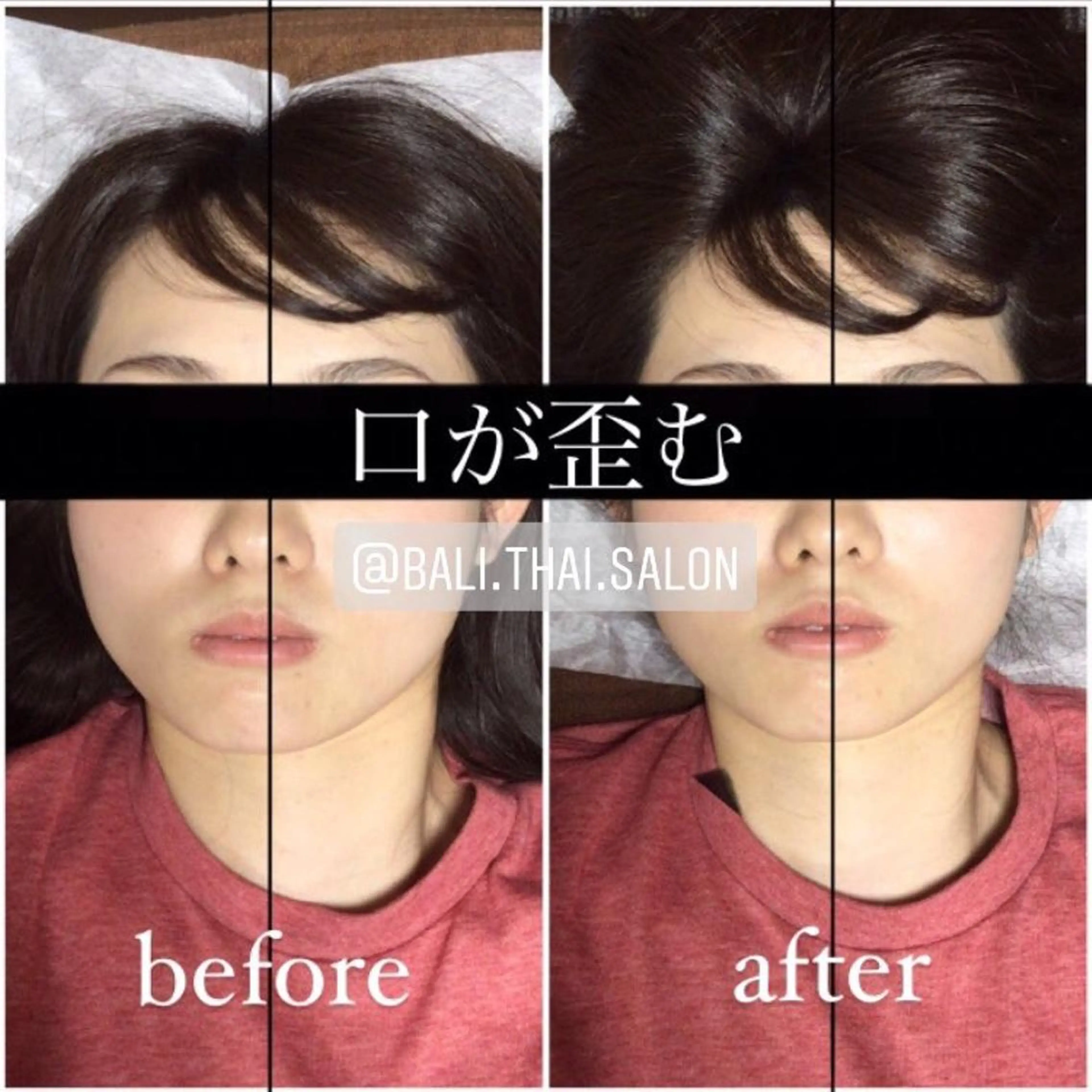 minimo特別❣️あご＋頭蓋骨小顔矯正 💆🏻‍♀️ 顔の歪み 全部込み❤️ お試しパーフェクトコースの写真