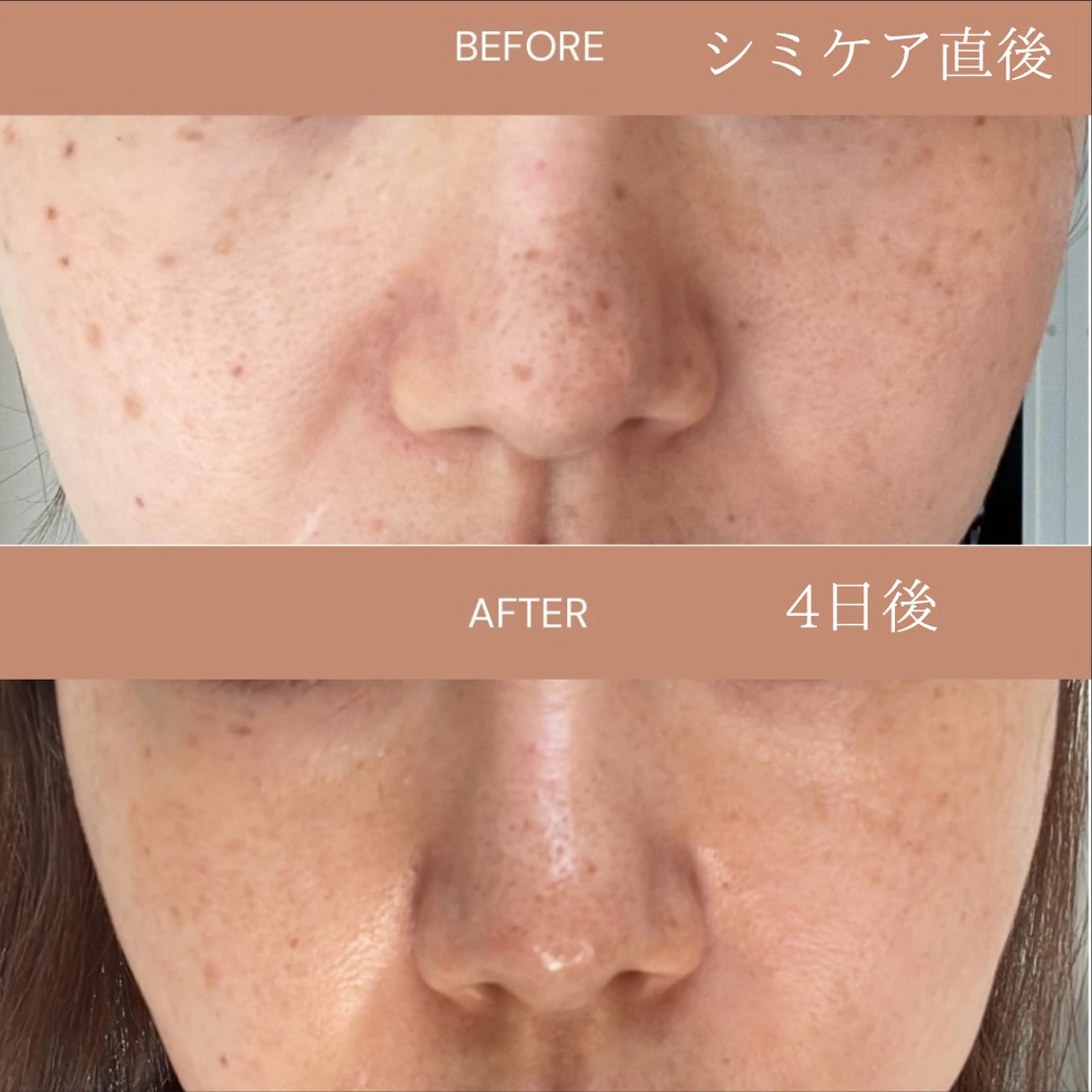 エステ 肌質改善エステ chiffonのエステ・リラクイメージ