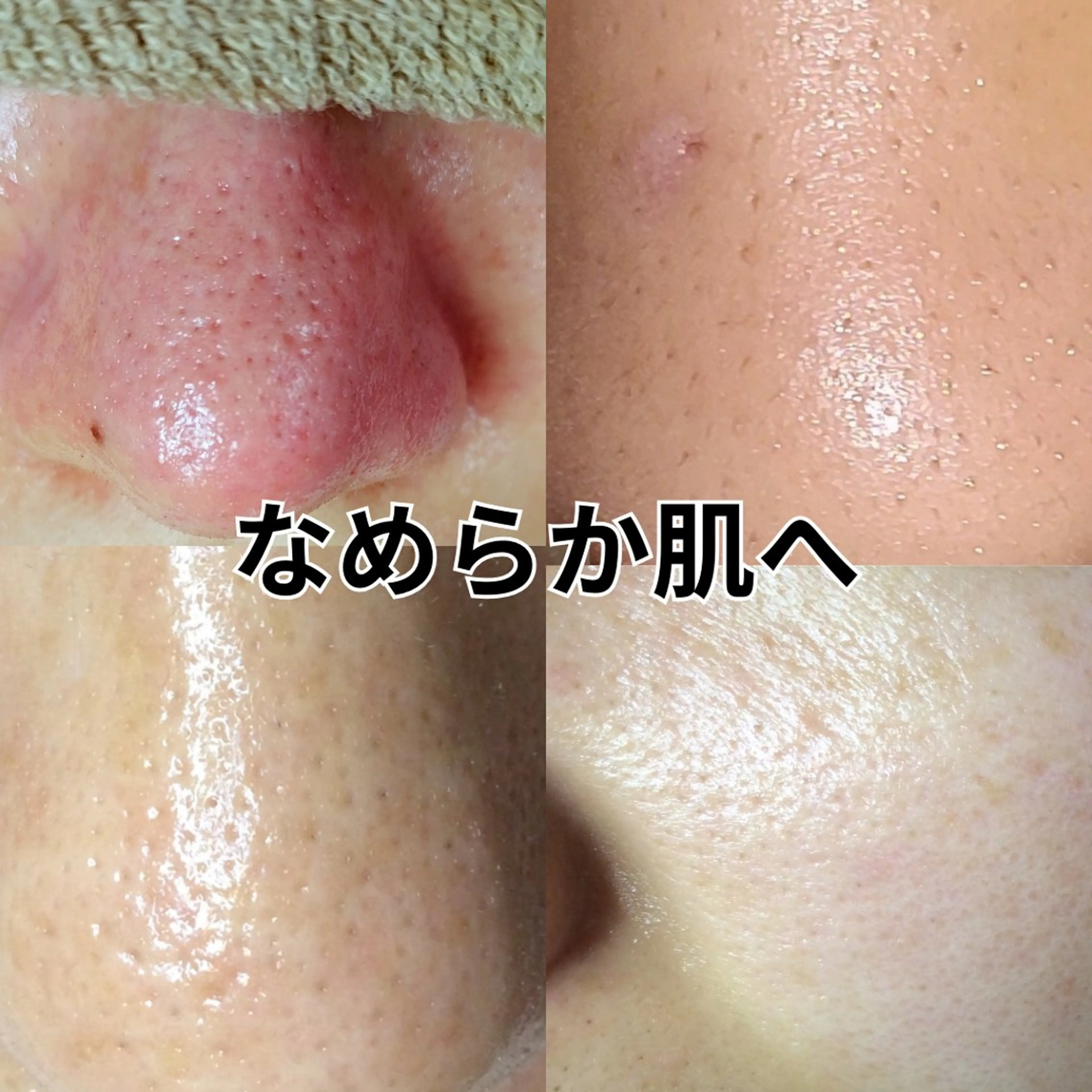 エステ エステサロン　Lazulisea所属・川口 春奈のエステ・リラクイメージ