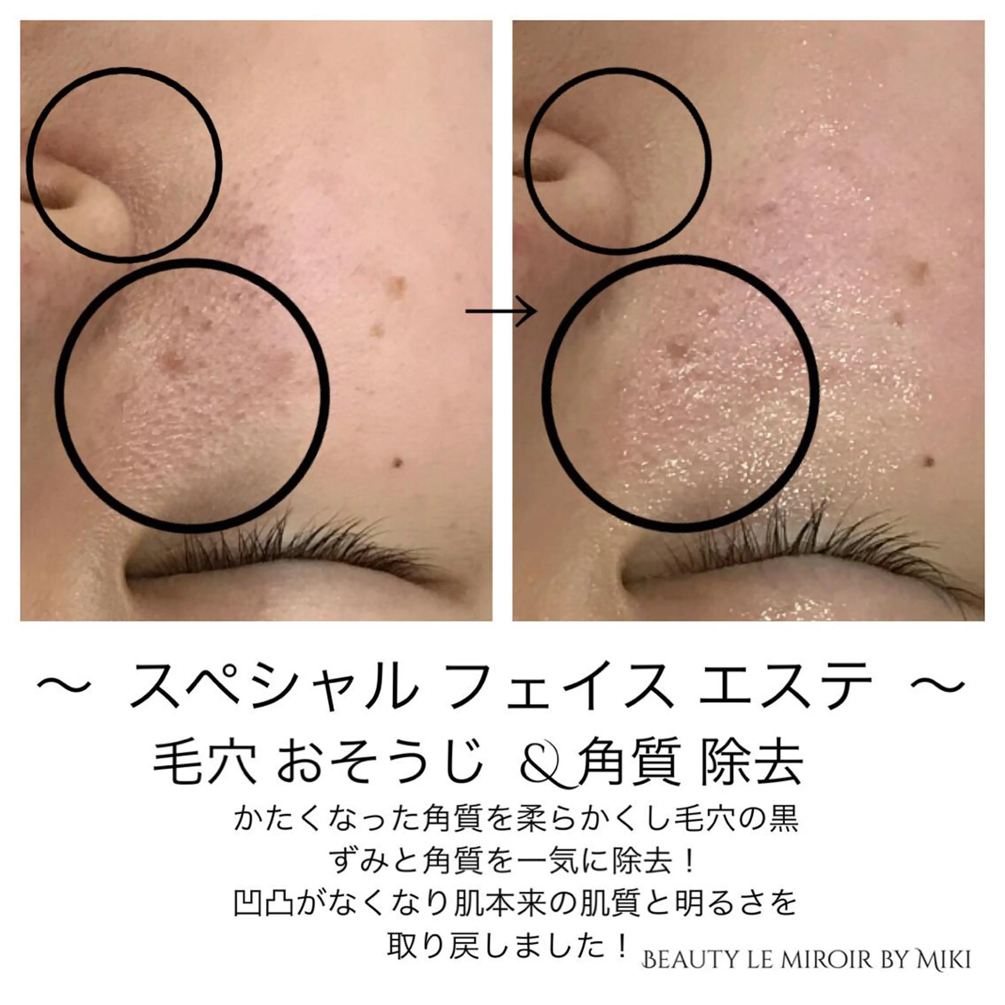 ビューティー ミロワールのエステ・リラクイメージ