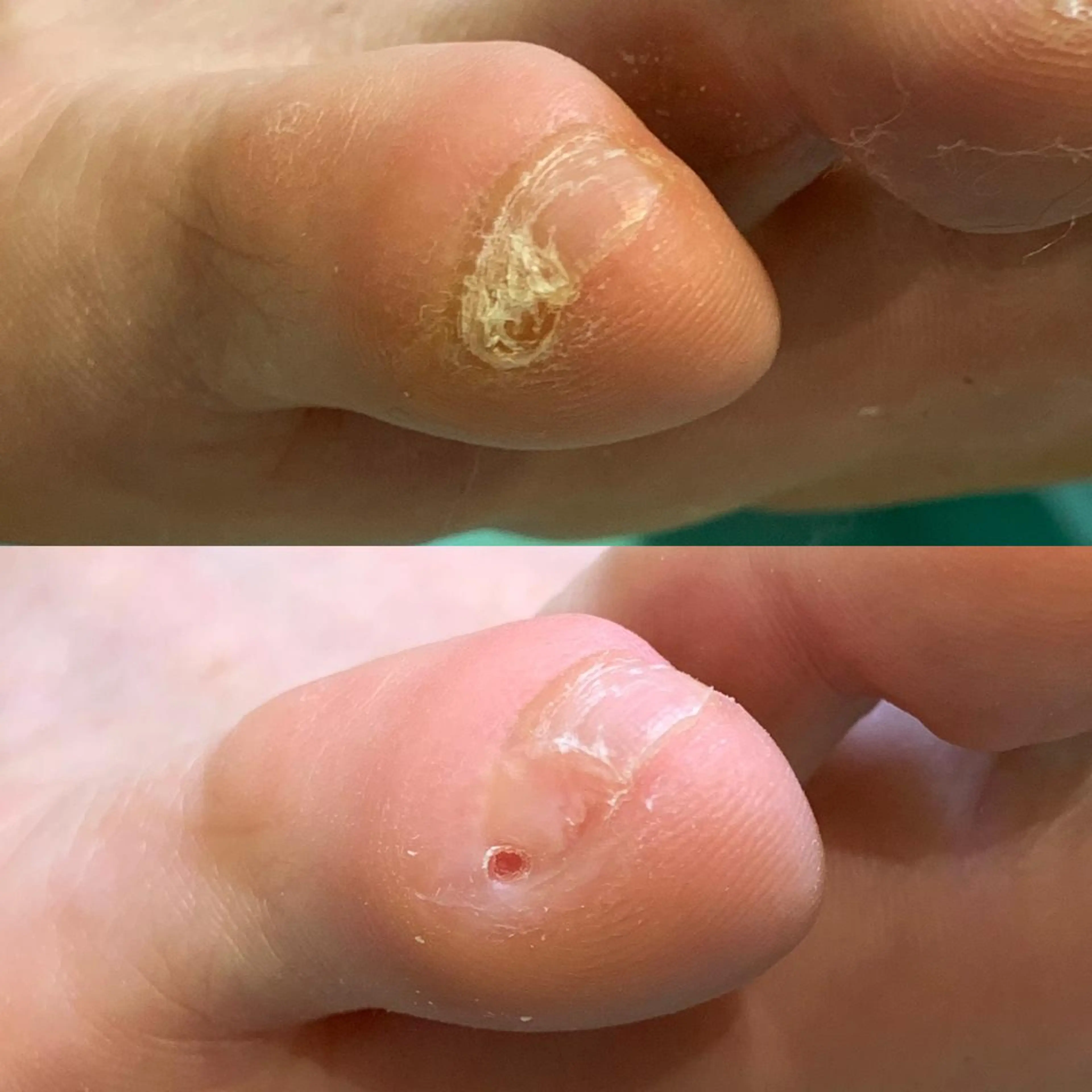 東京巻き爪アカデミー所属・東京巻き爪 アカデミーのエステ・リラクイメージ