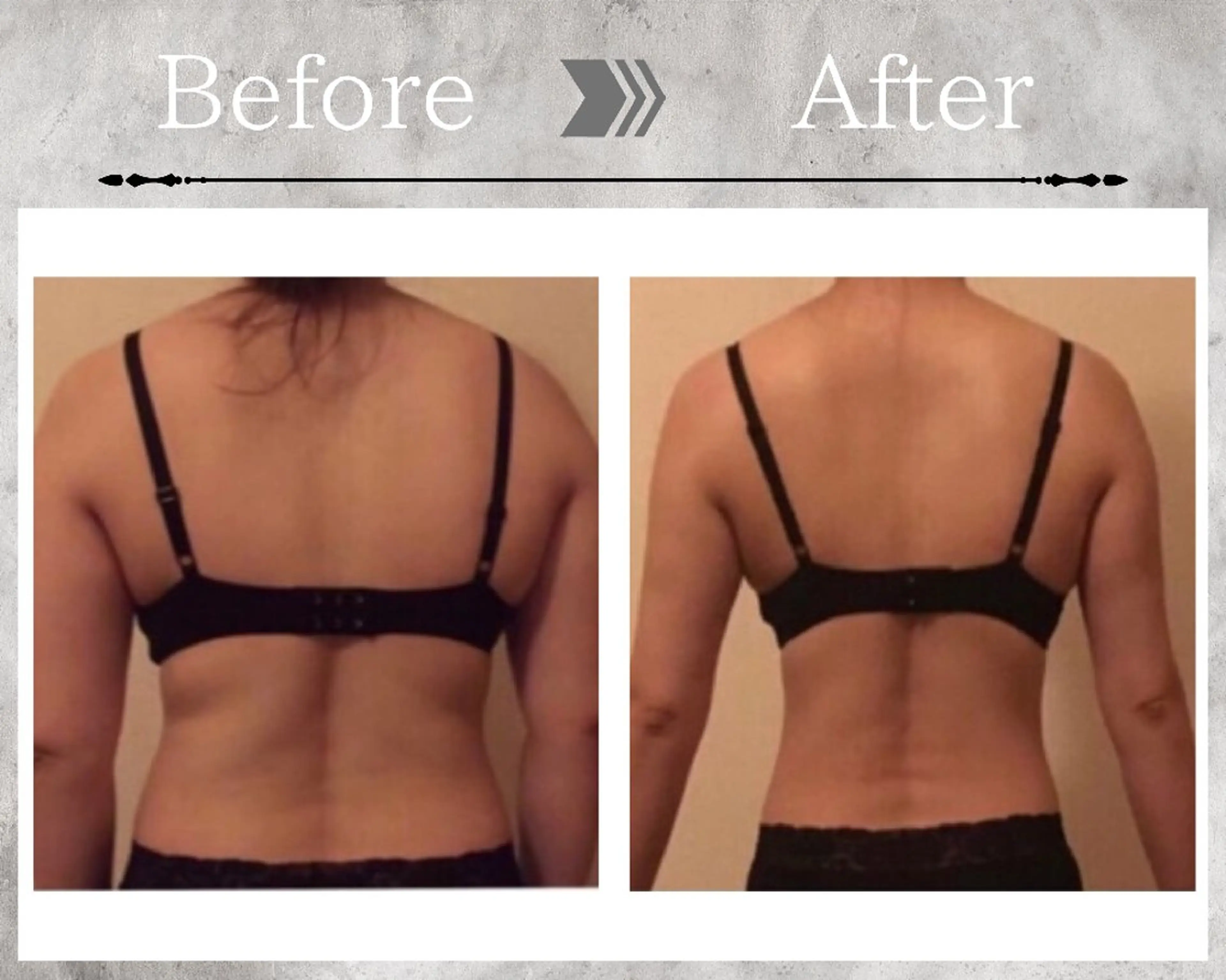 その他 【バストケアサロン】 Feliz フェリスのエステ・リラクイメージ