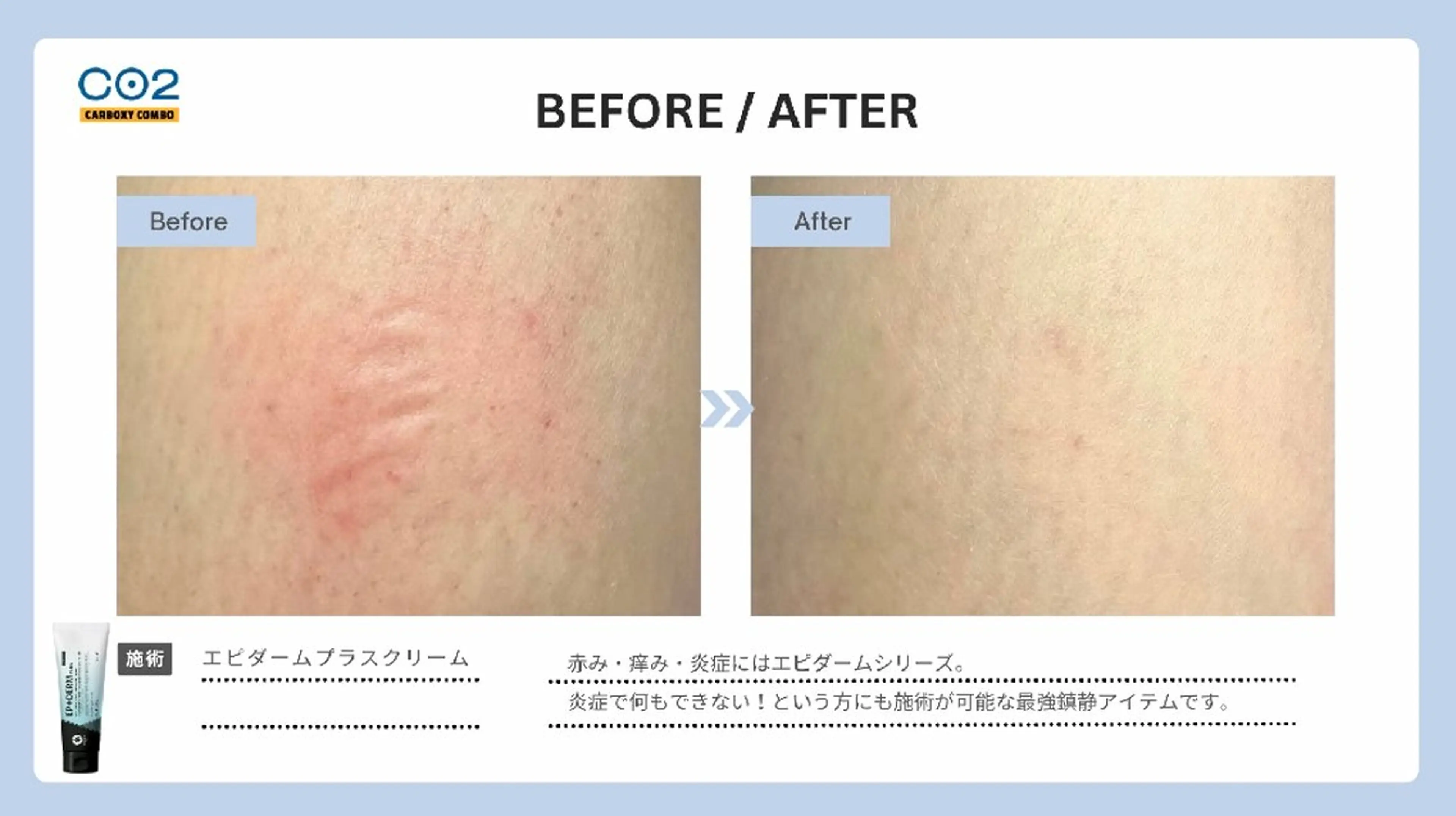 肌質改善 KALANCHOEのエステ・リラクイメージ