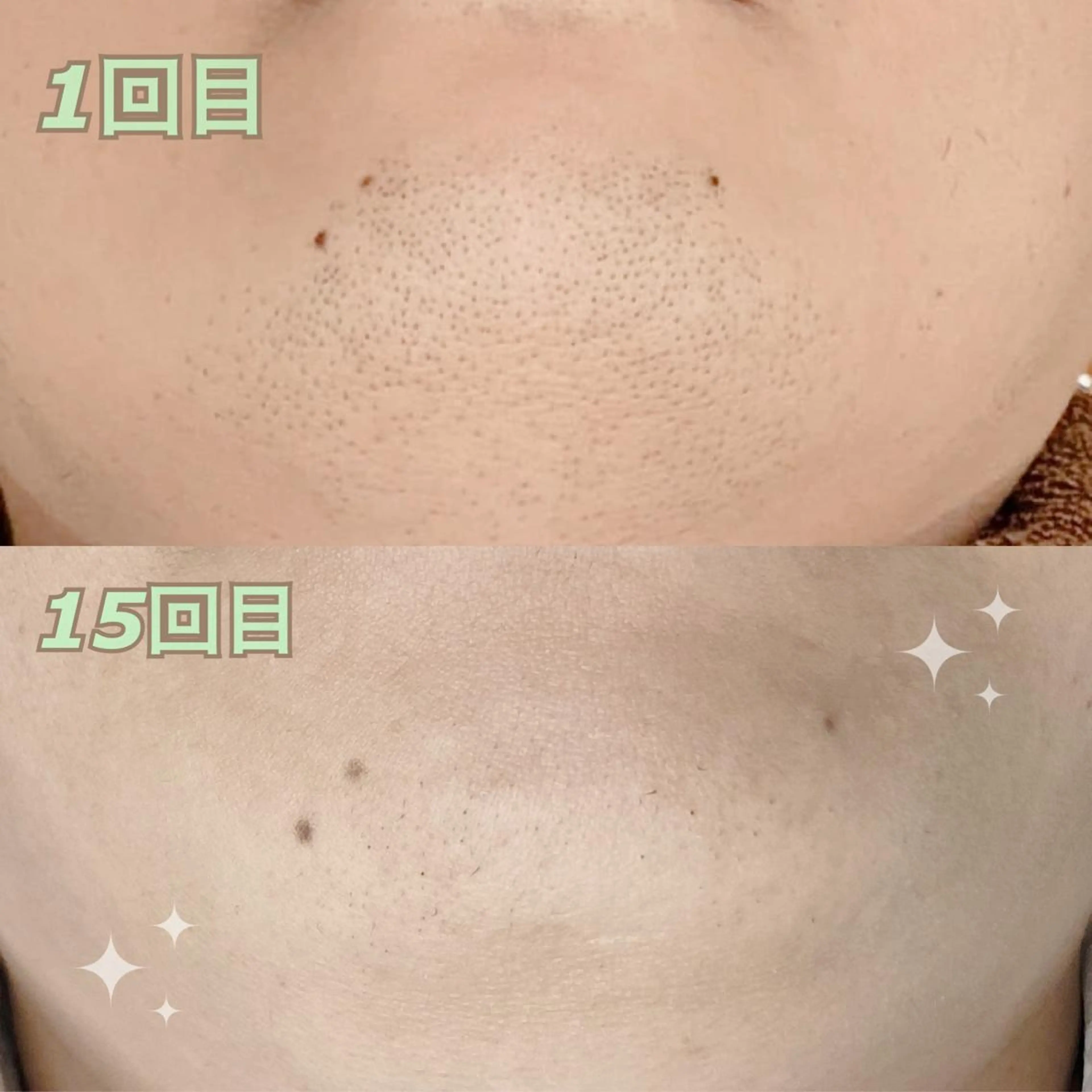 メンズ 脱毛 Luce所属・LUCE メンズ脱毛のエステ・リラクイメージ