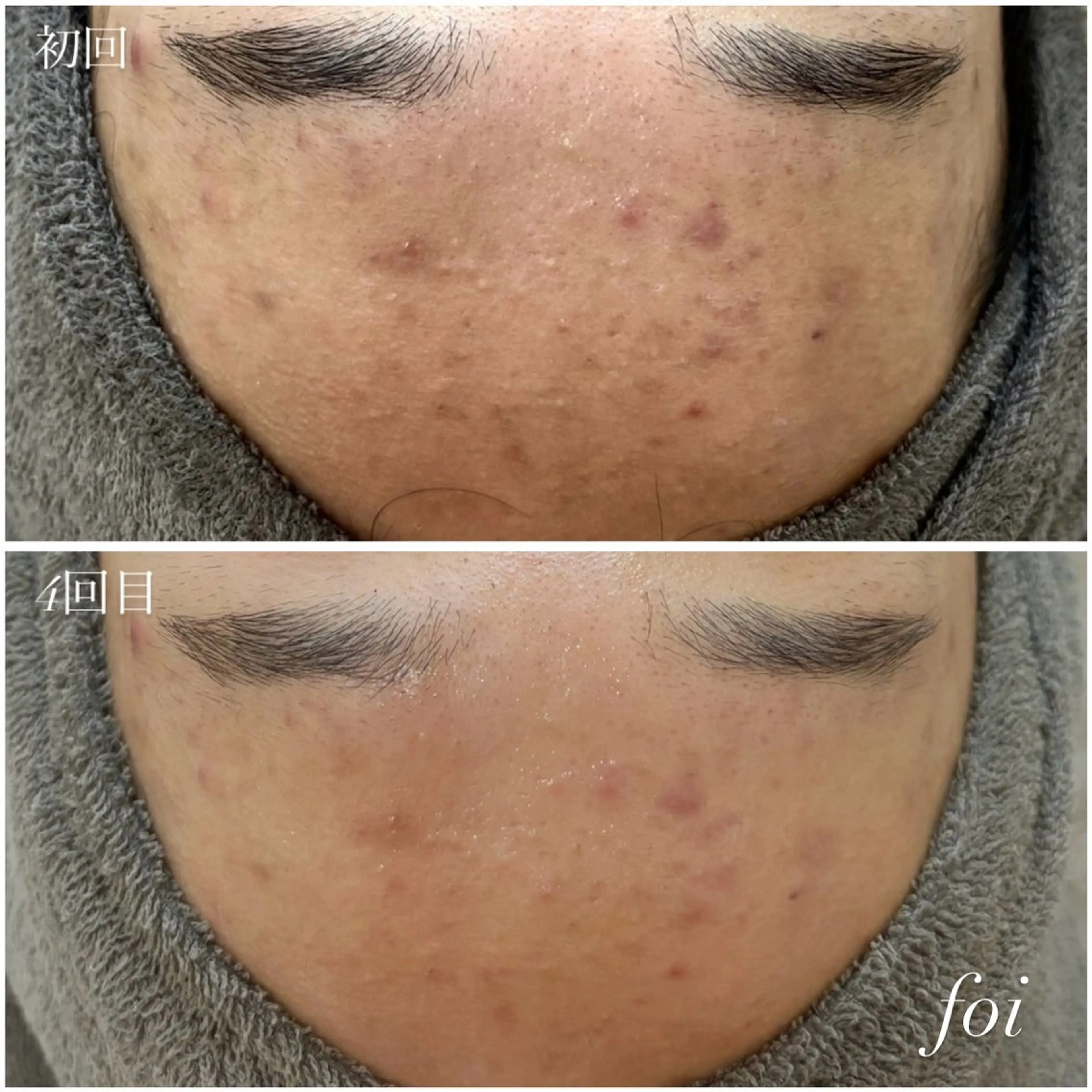 艶肌デトックス🫧 Samiraのエステ・リラクイメージ