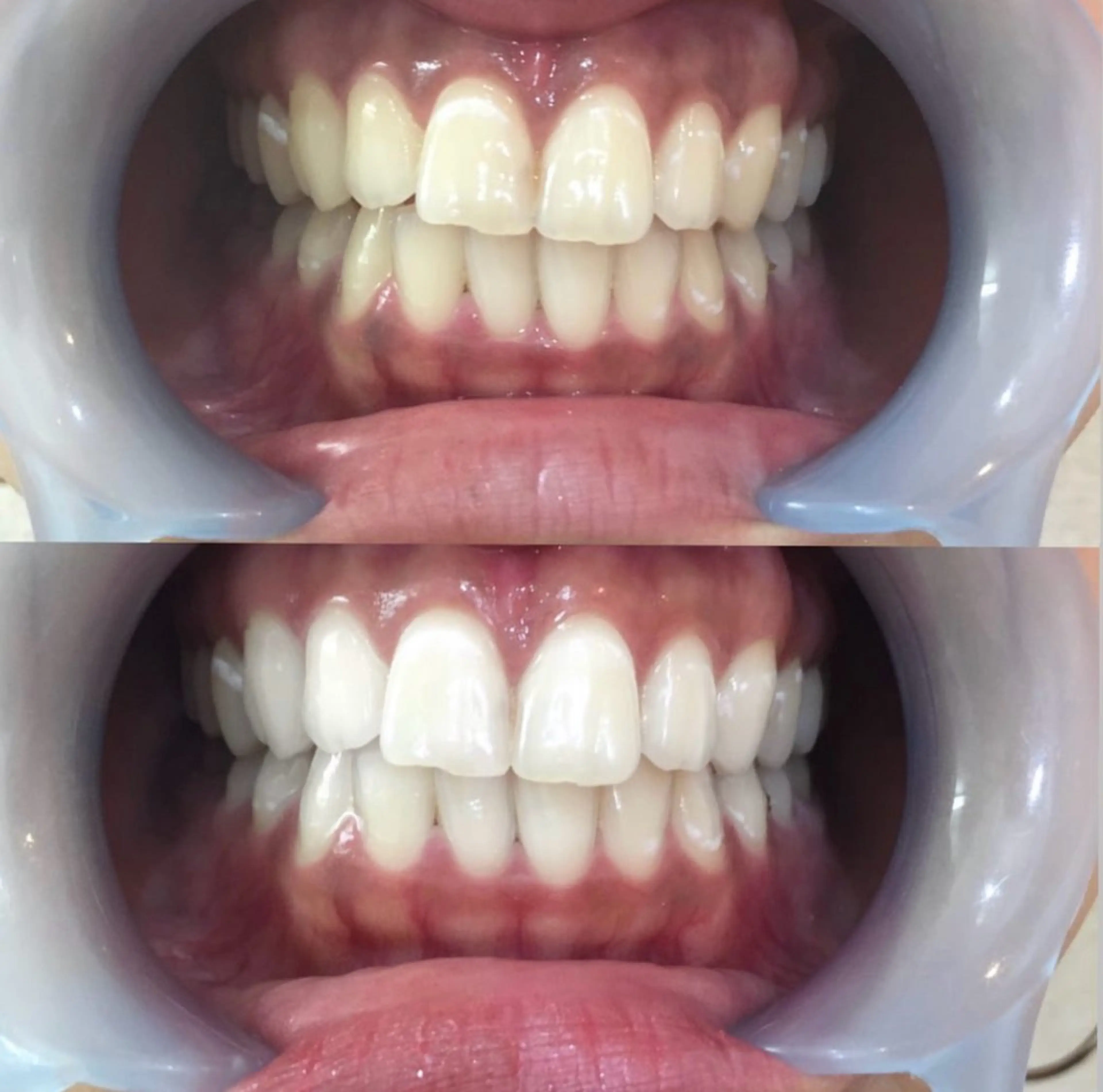 LOVE ホワイトニング戸辺のその他イメージ