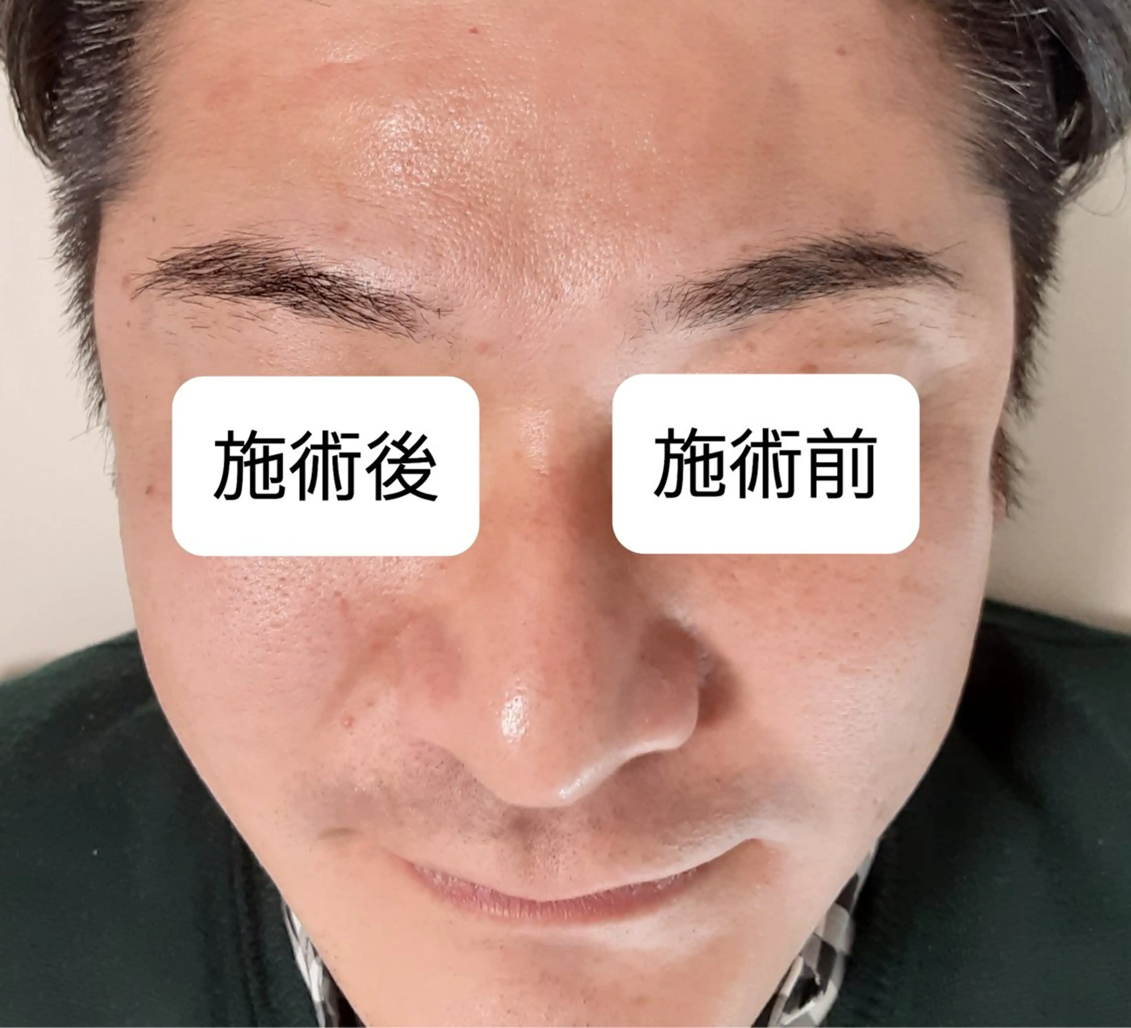 五十嵐 蓮のその他イメージ