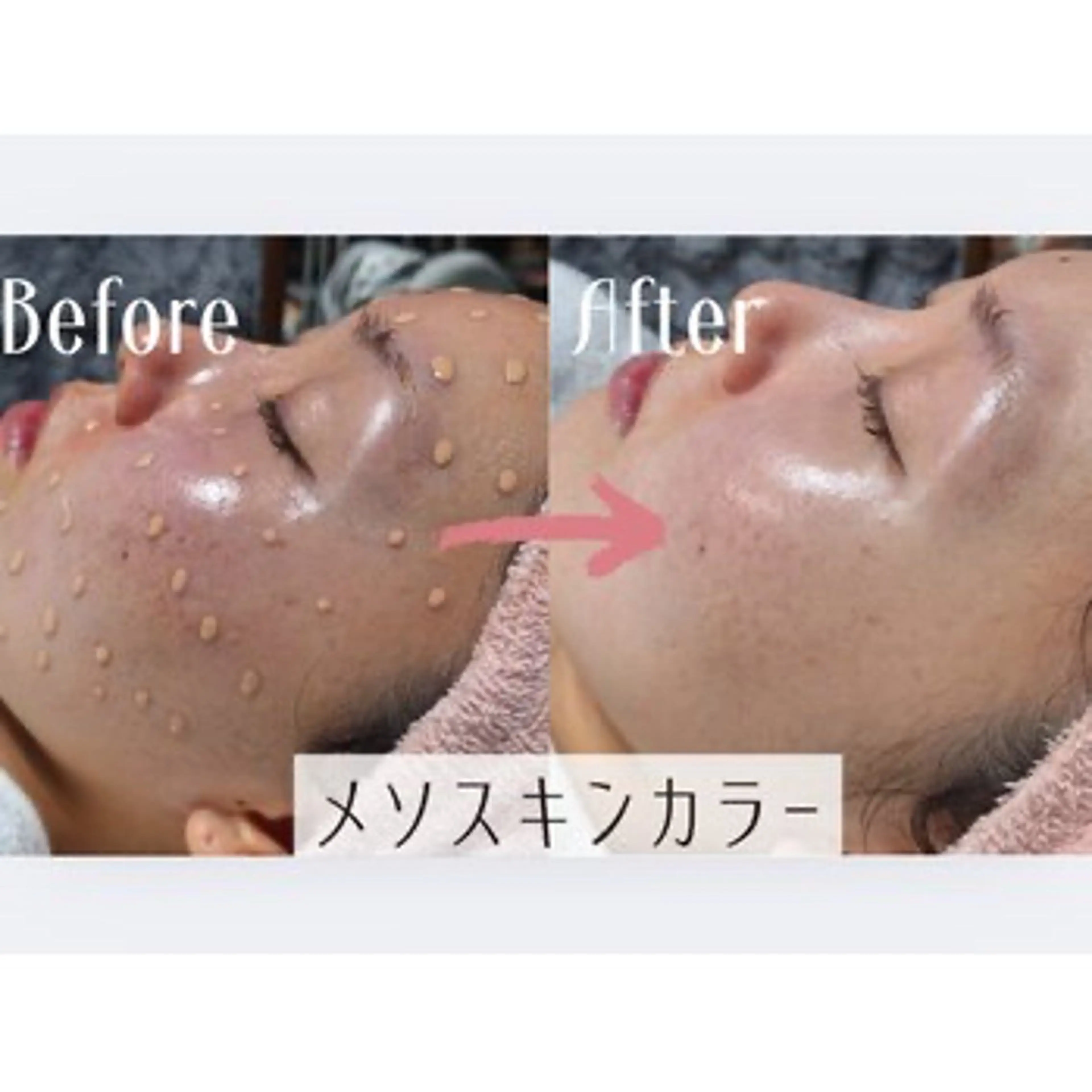 メソスキンカラー ティントファンデーション ファンデーションアートメイクの写真