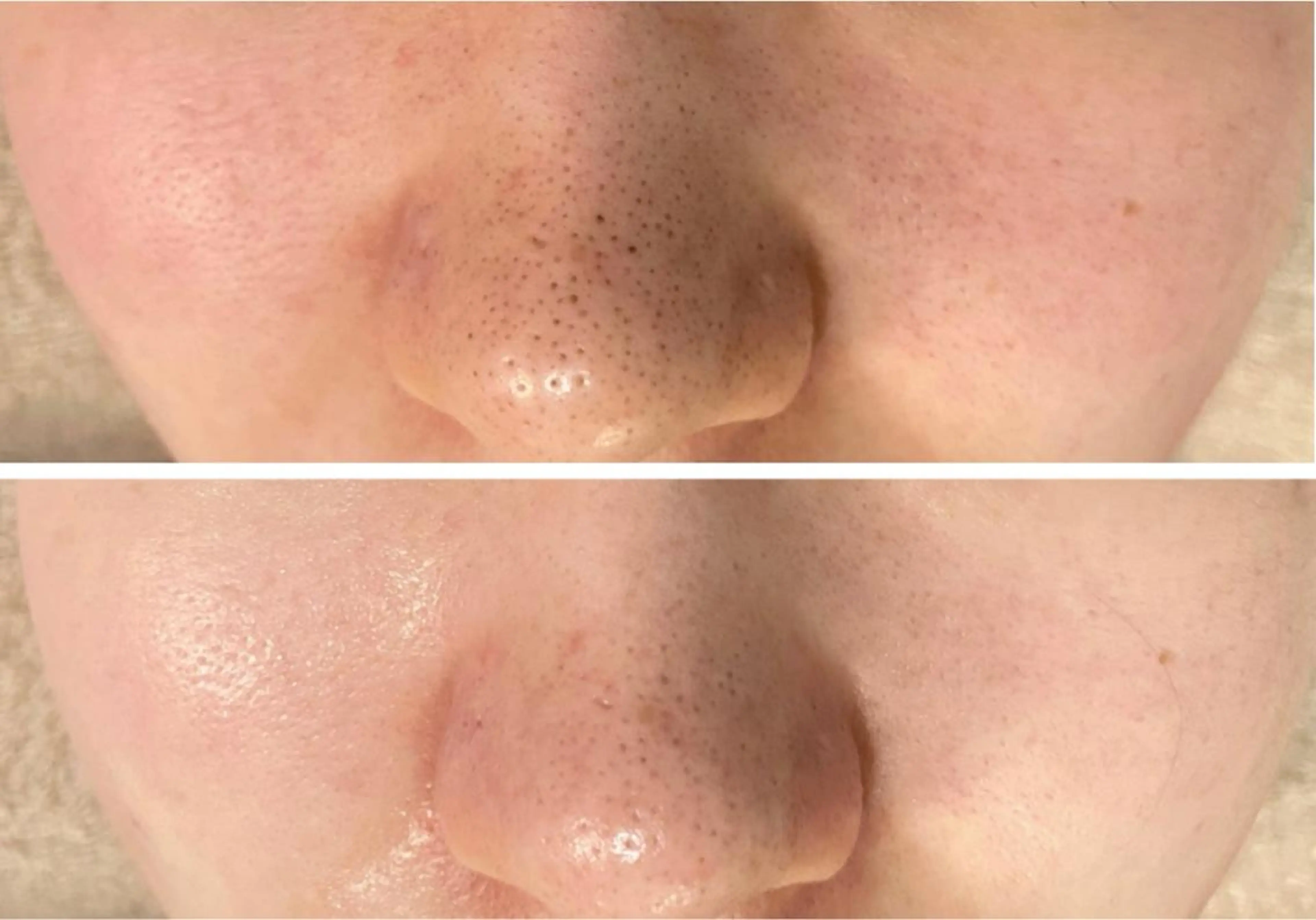 毛穴・シミ専門サロン ルパークのエステ・リラクイメージ