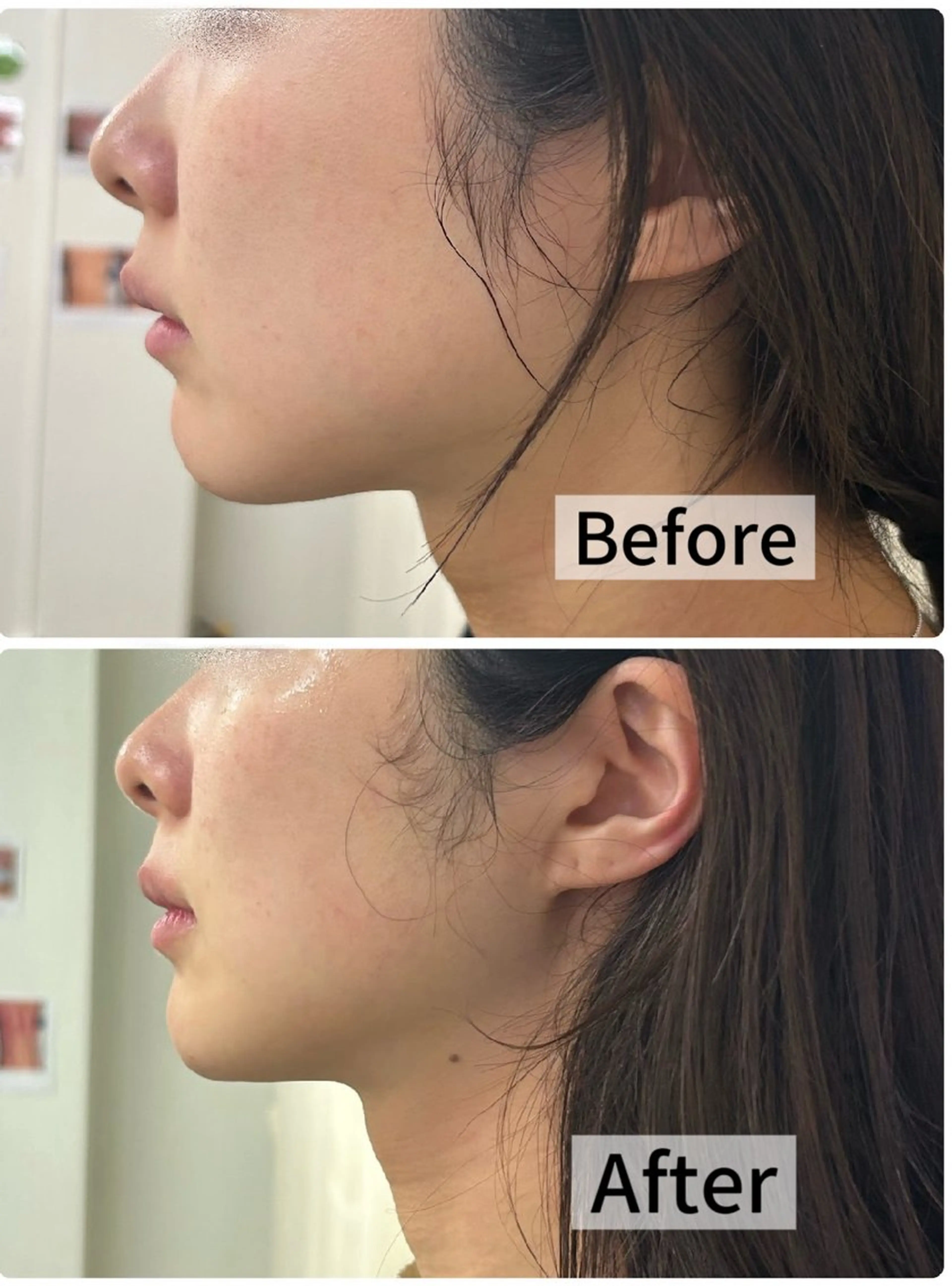 LUMINA ESTHのエステ・リラクイメージ