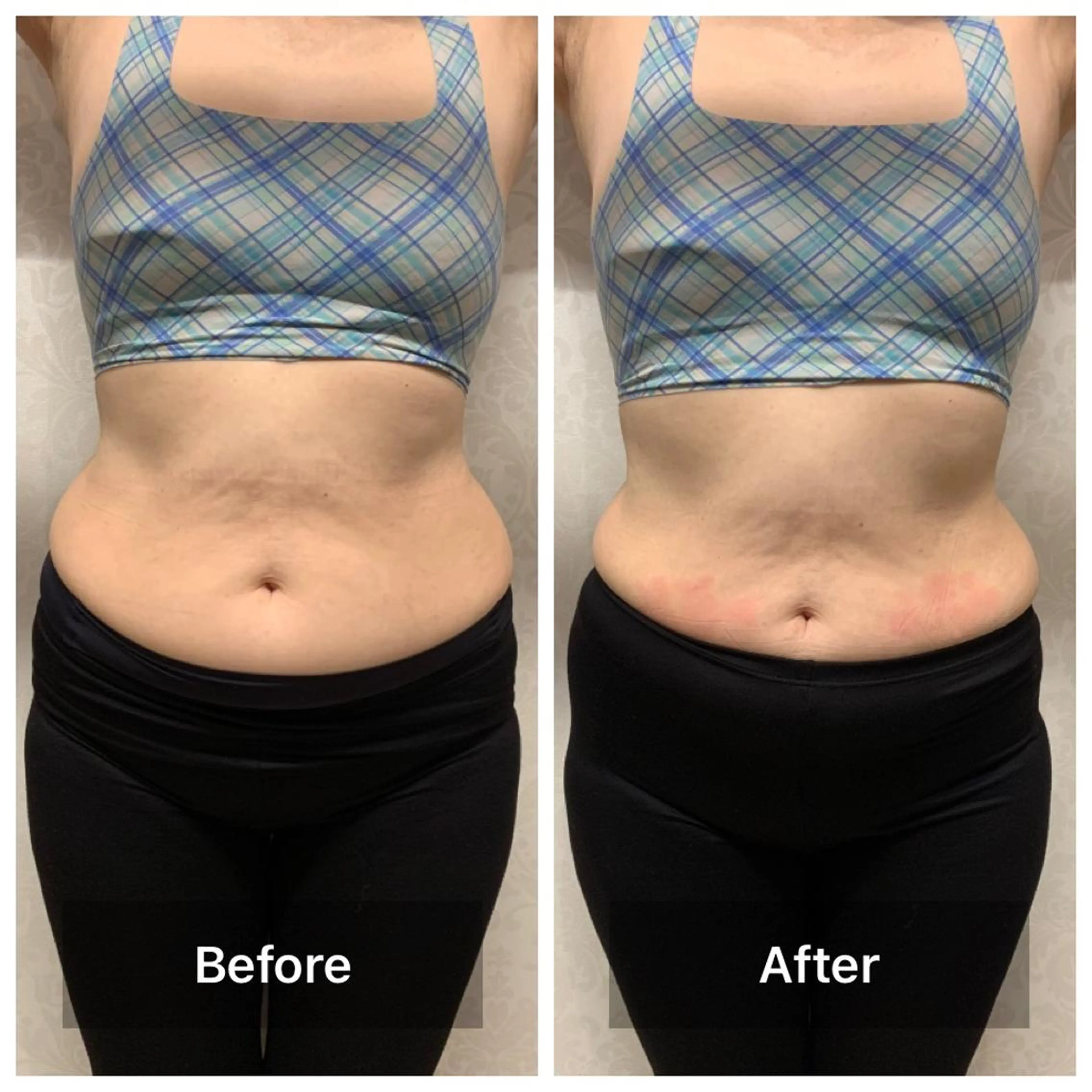 森谷 莉美のエステ・リラクイメージ