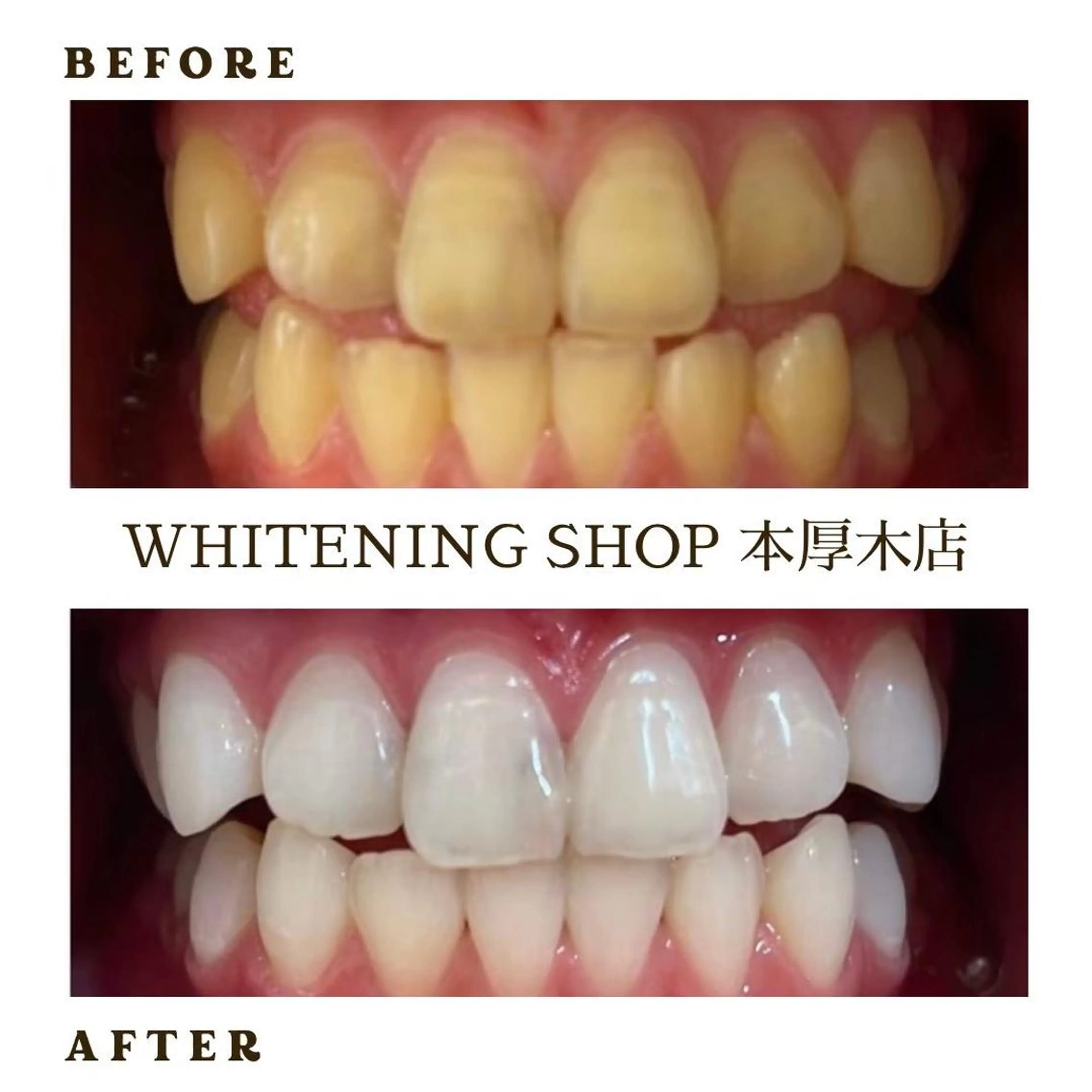 メンズ その他 ホワイトニング ショップ本厚木のその他イメージ