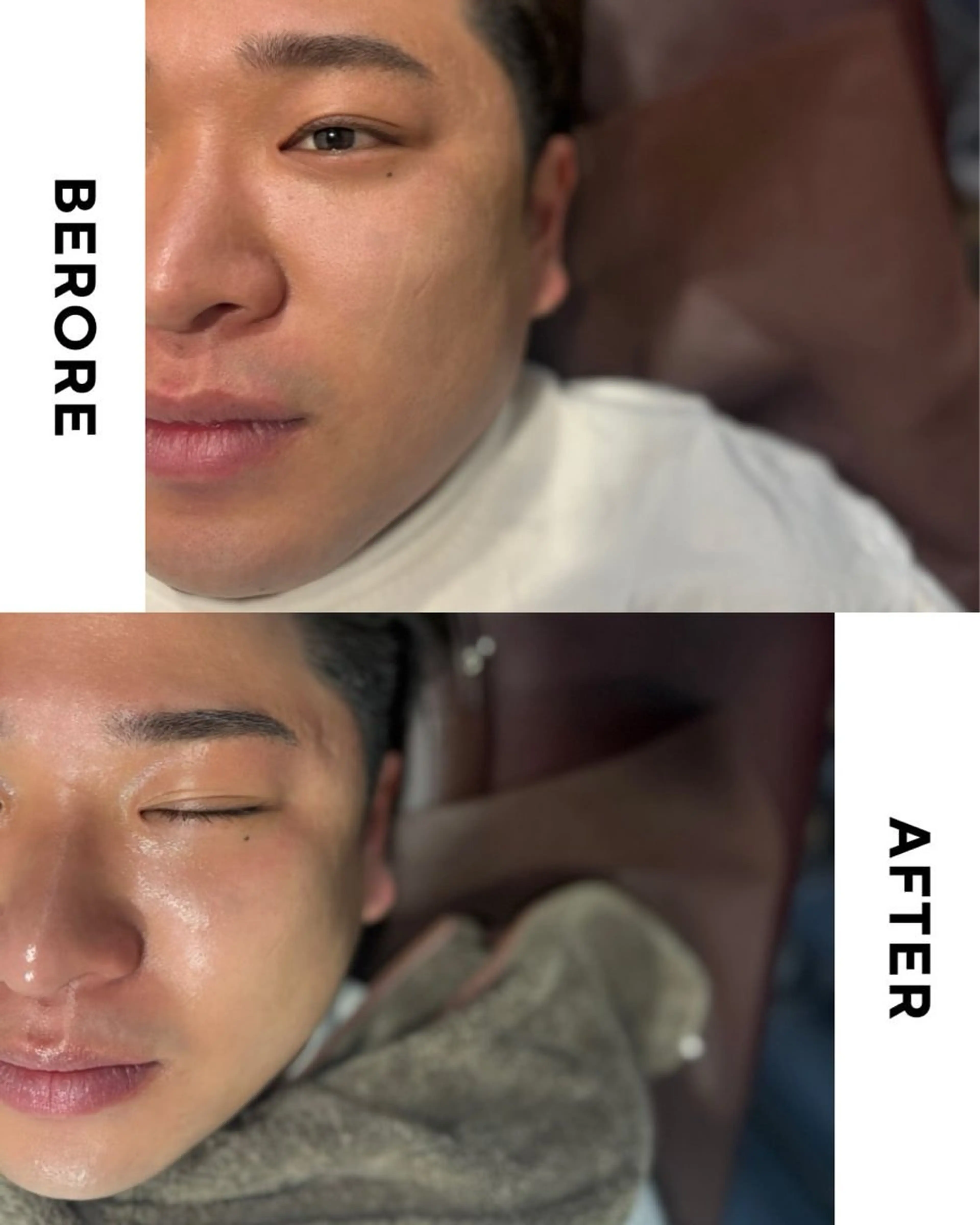 メンズ エステ リラク 大阪脱毛|ちぇるま| 眉毛Wax｜美肌管理のエステ・リラクイメージ