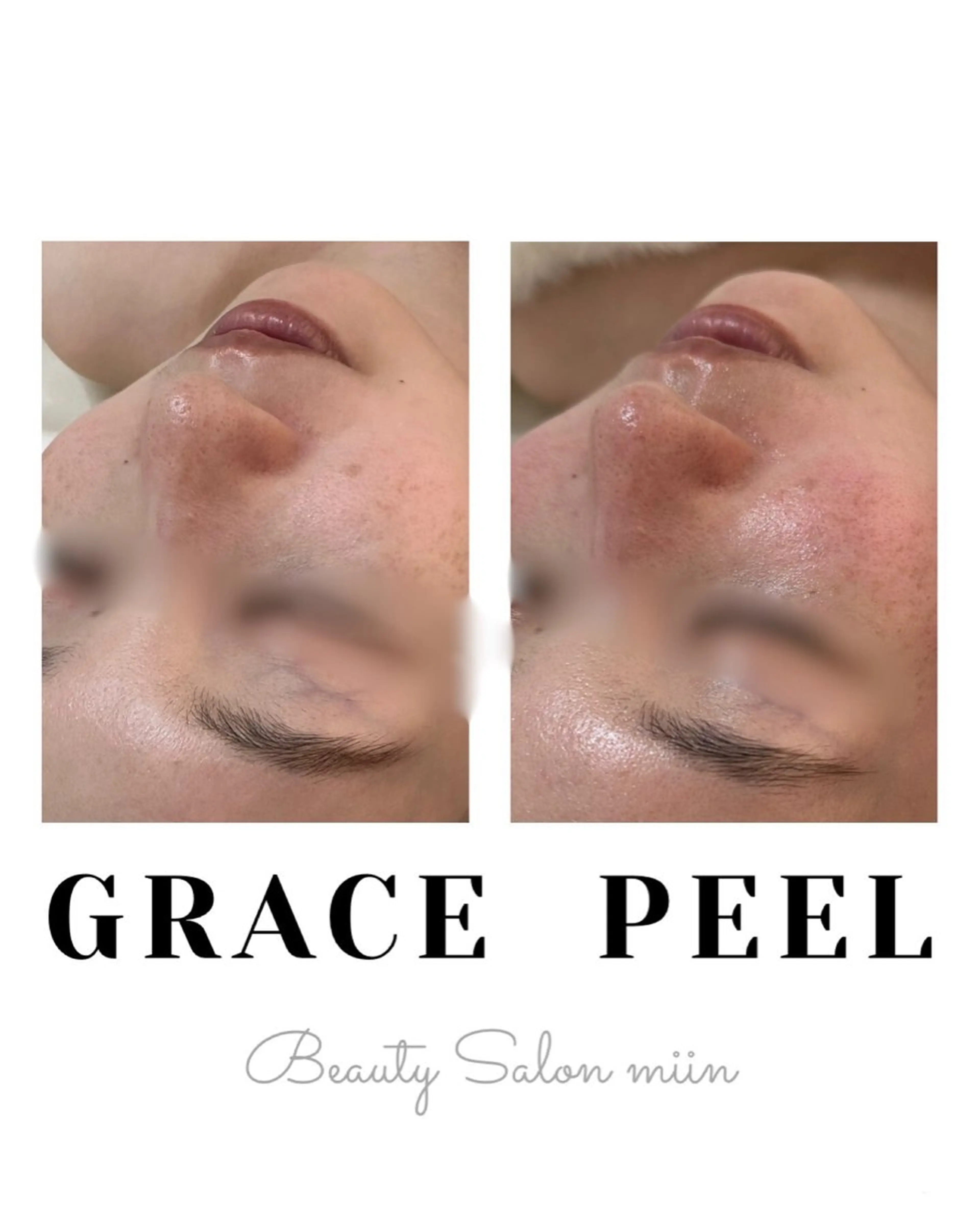 エステ 韓国肌管理 白玉肌管理®︎のエステ・リラクイメージ