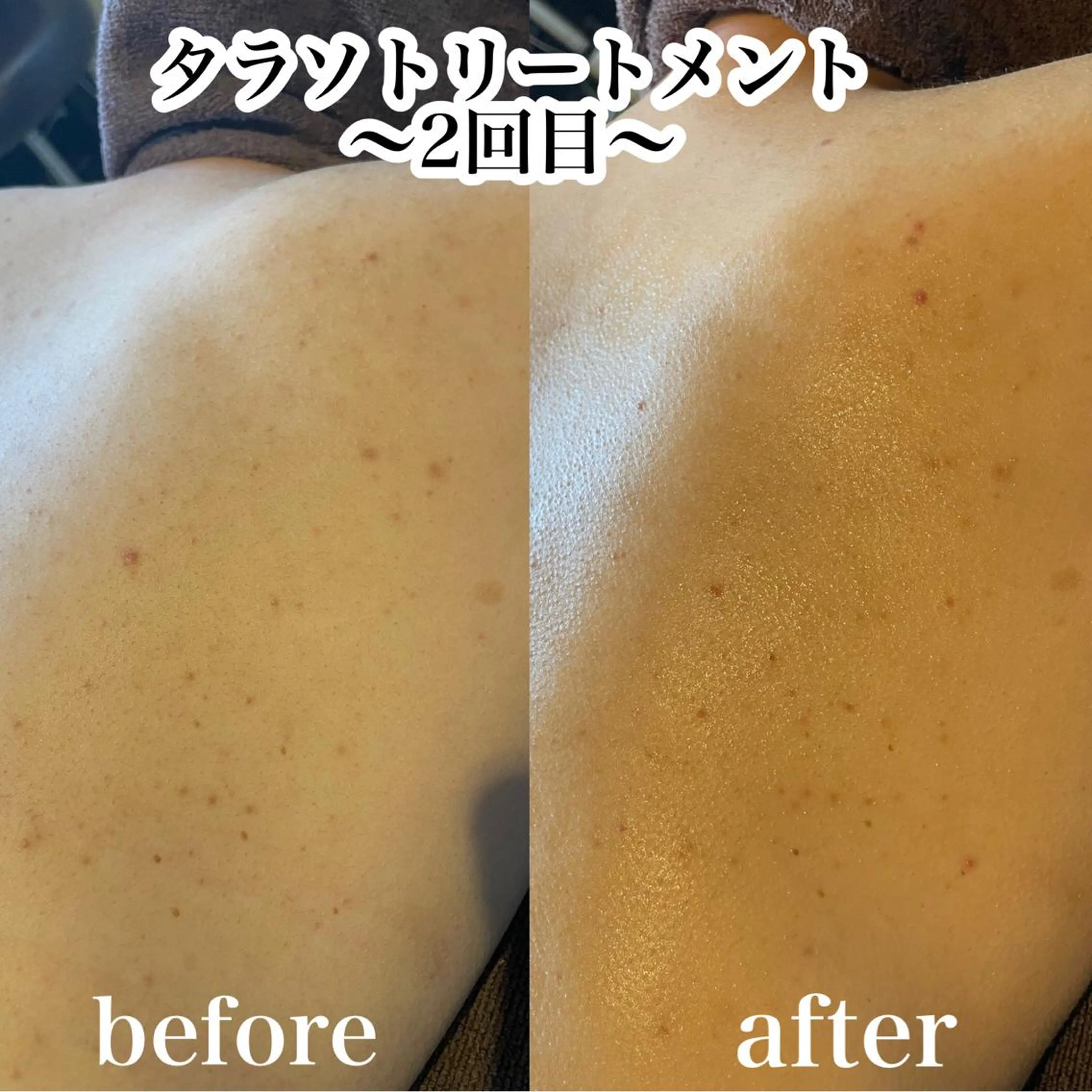 エステ 浜野 恵美のエステ・リラクイメージ