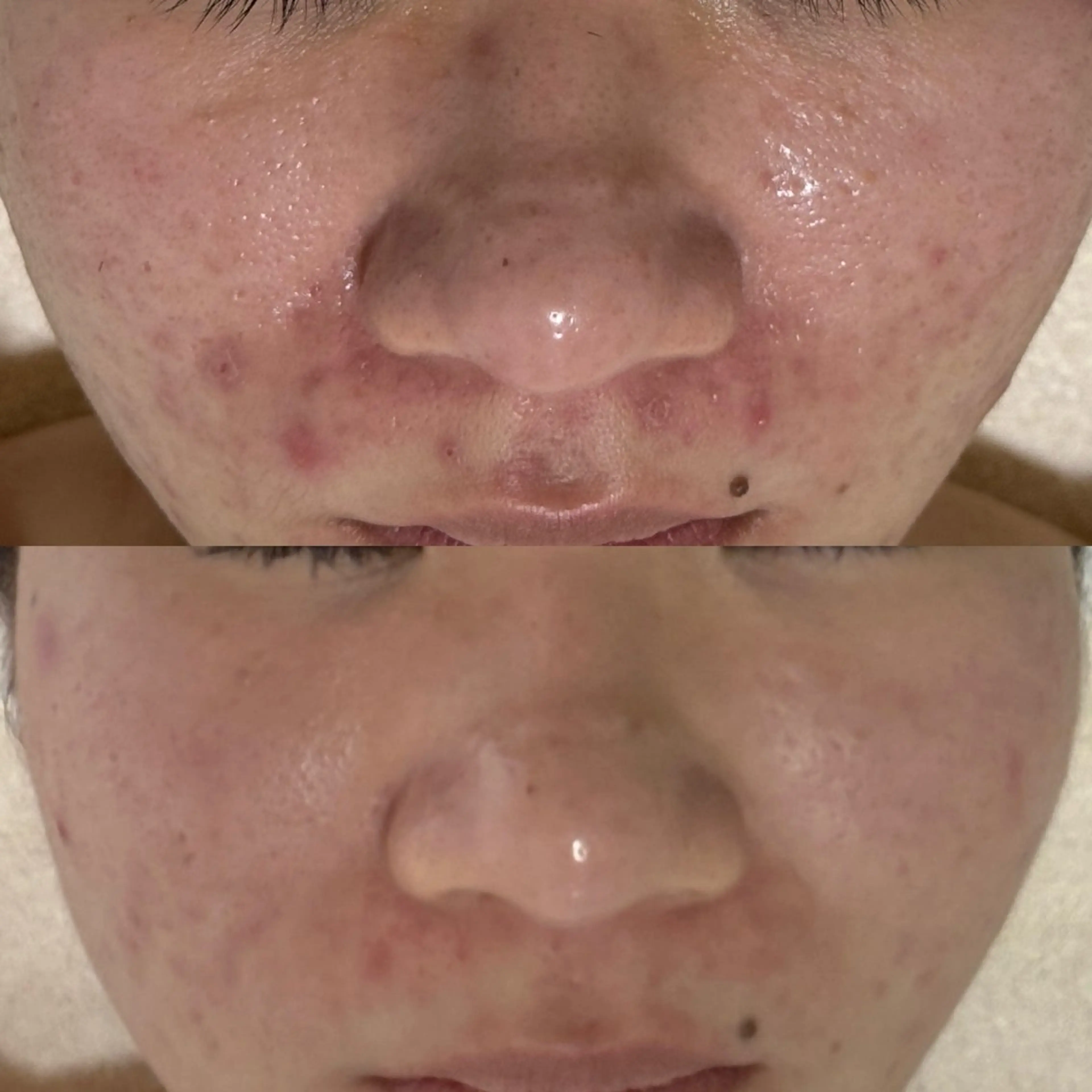 ニキビ・毛穴・ フェイシャル専門店のエステ・リラクイメージ